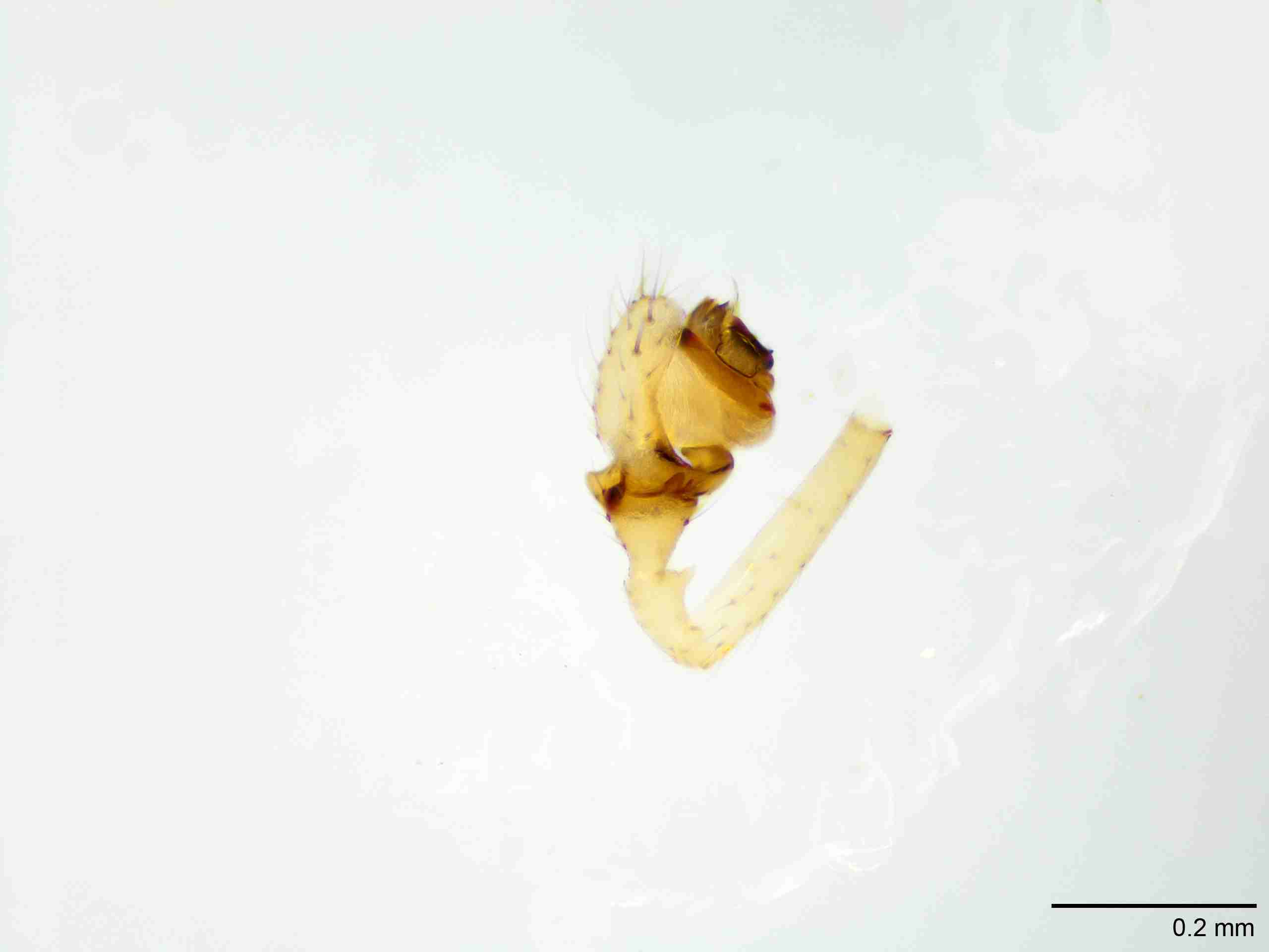 XILLINY067mppalpJAM905_100X_E2A.jpg