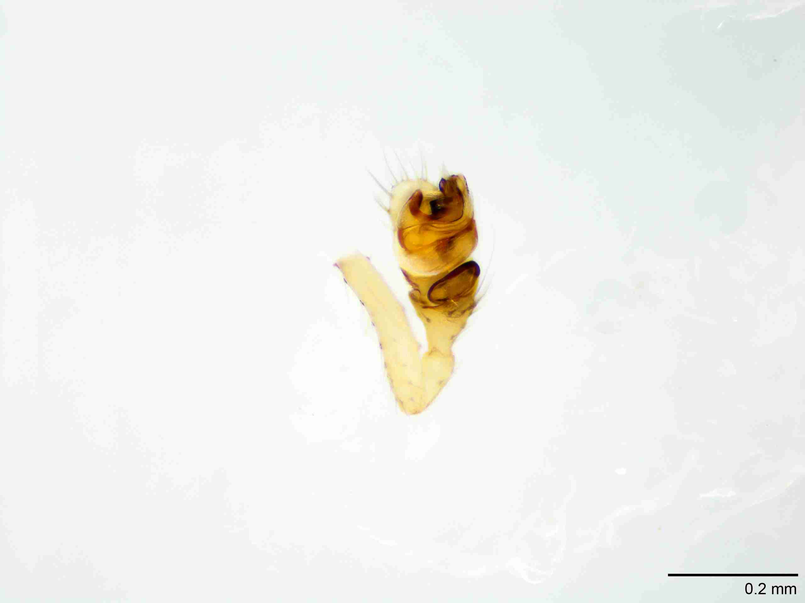 XILLINY067mppalvJAM905_100X_E2A.jpg