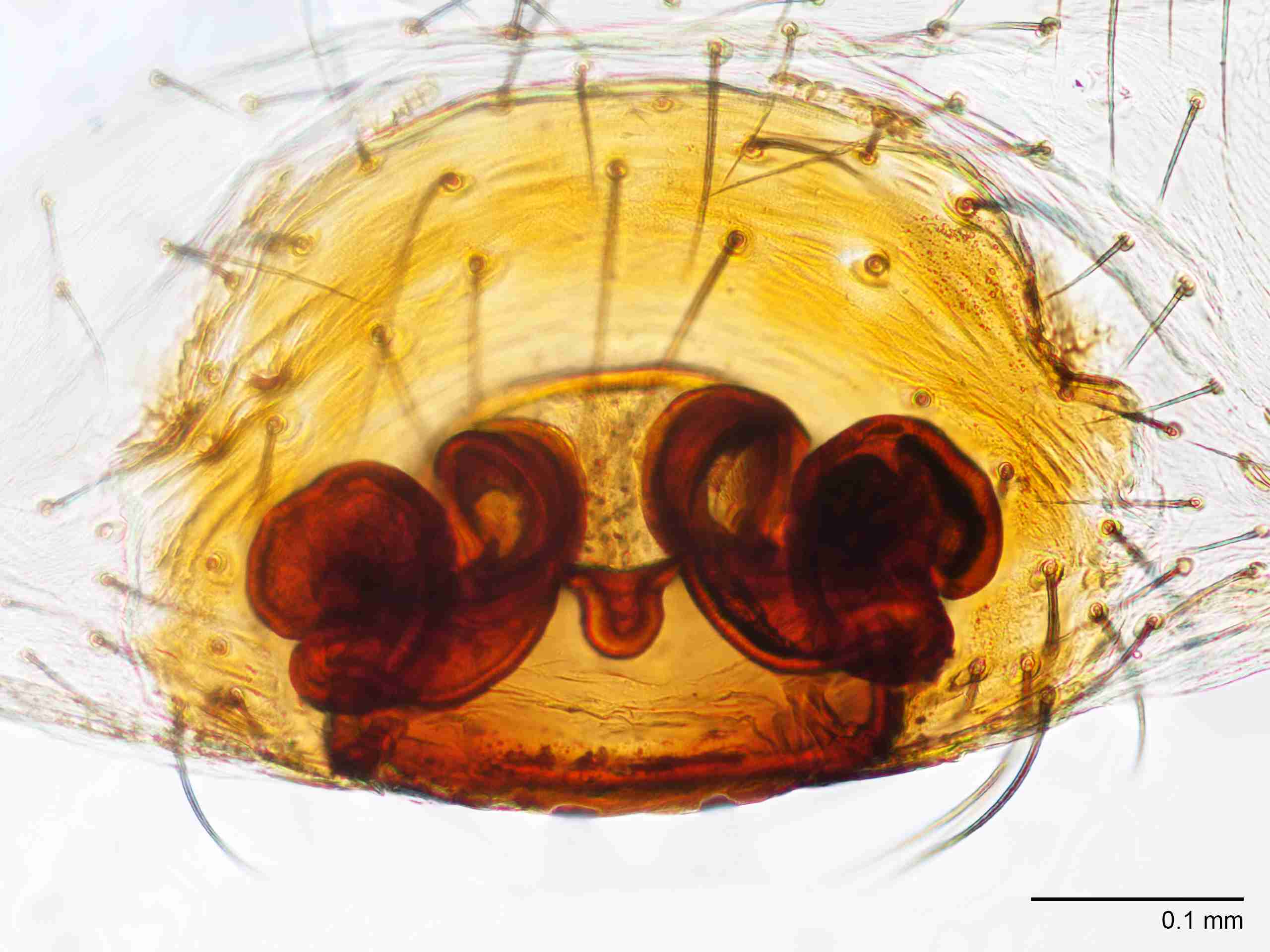 XILLINY068fpepidJAM903_200X_CAS.jpg