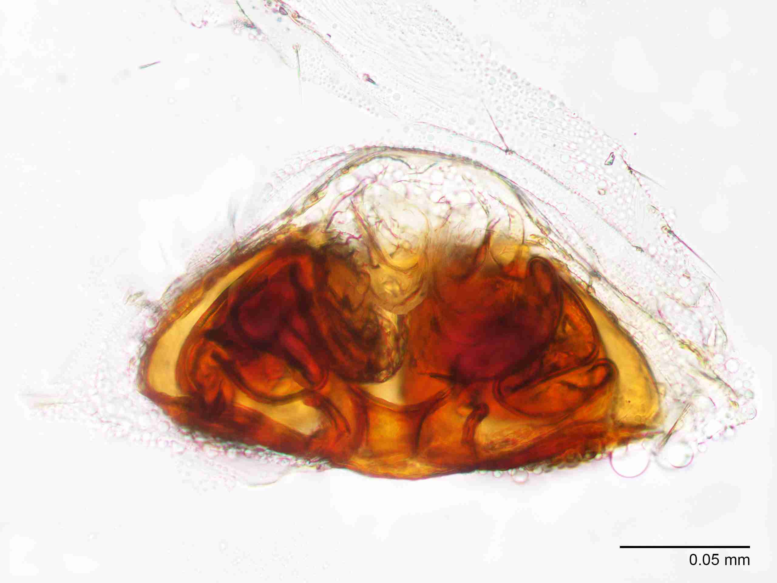 XILLINY069fpepidJAM900_400X_E2A.jpg