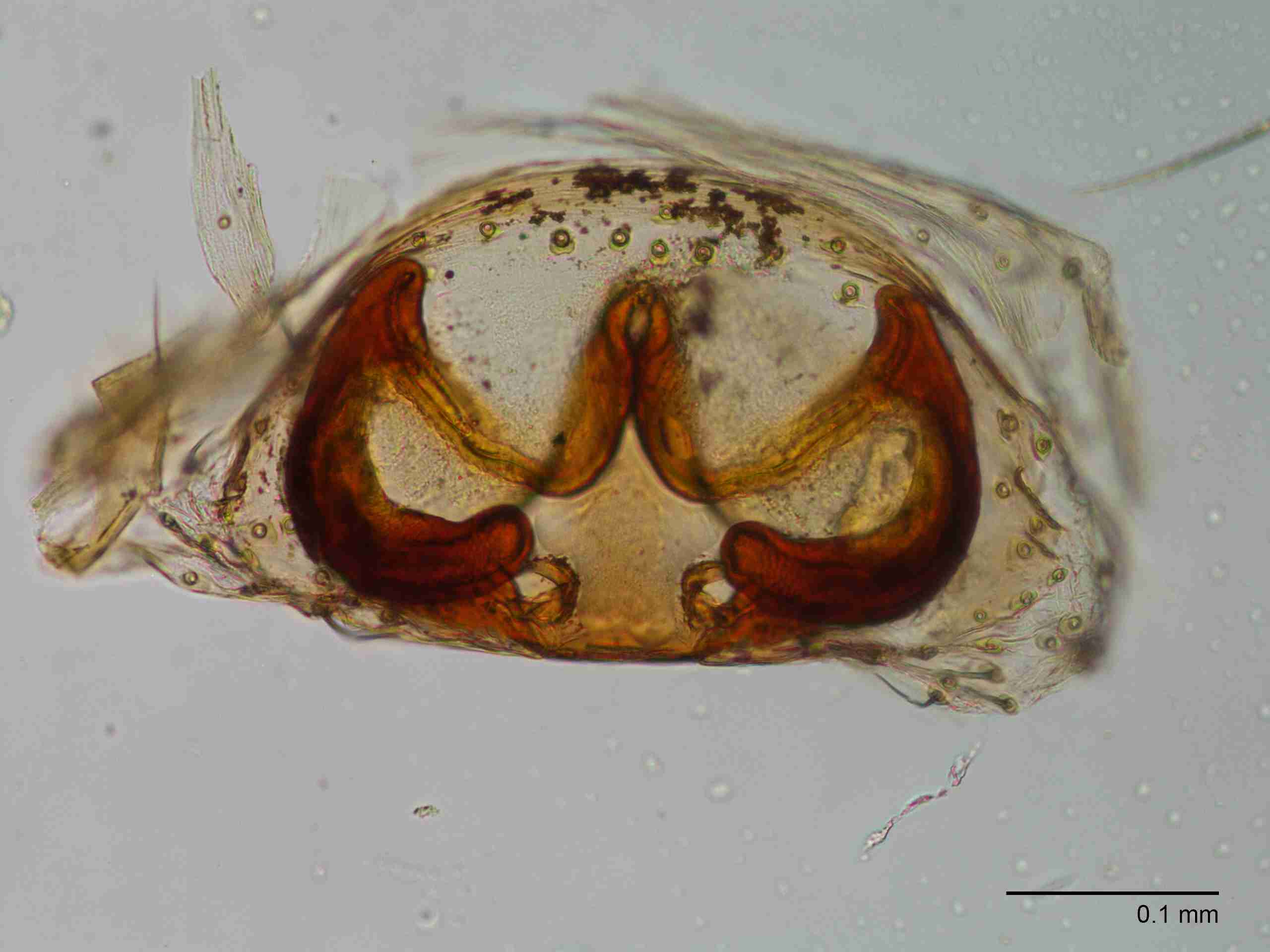 XILLINY070fpepidJAM260_200X_CAS.jpg