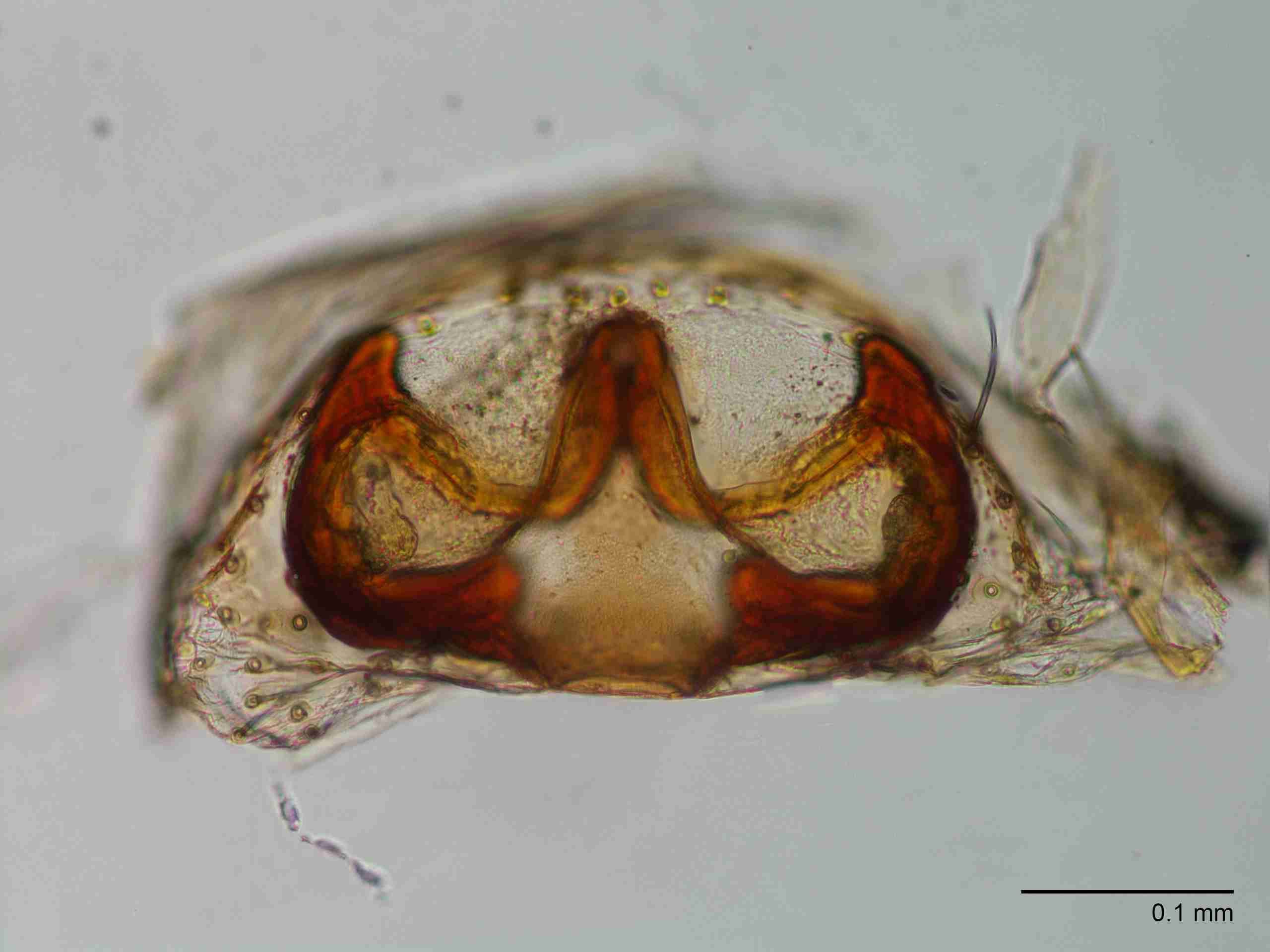 XILLINY070fpepivJAM260_200X_CAS.jpg