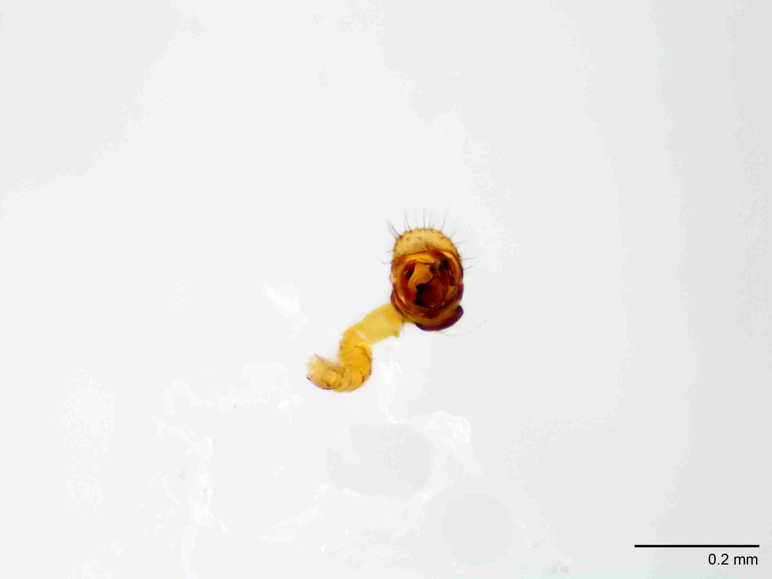 XILLINY071mppalaJAM027_100X_E2A.jpg