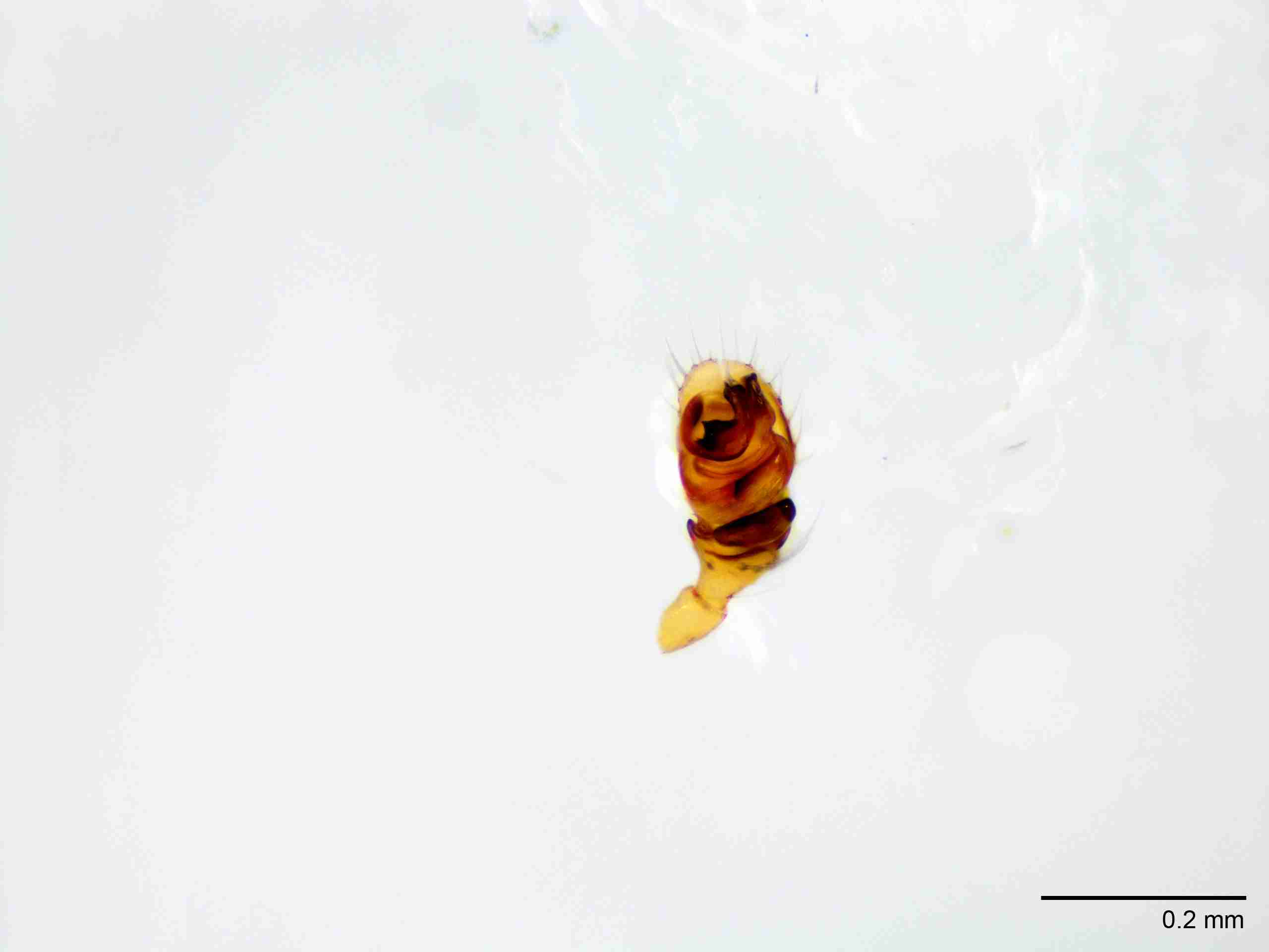 XILLINY071mppalvJAM027_100X_E2A.jpg
