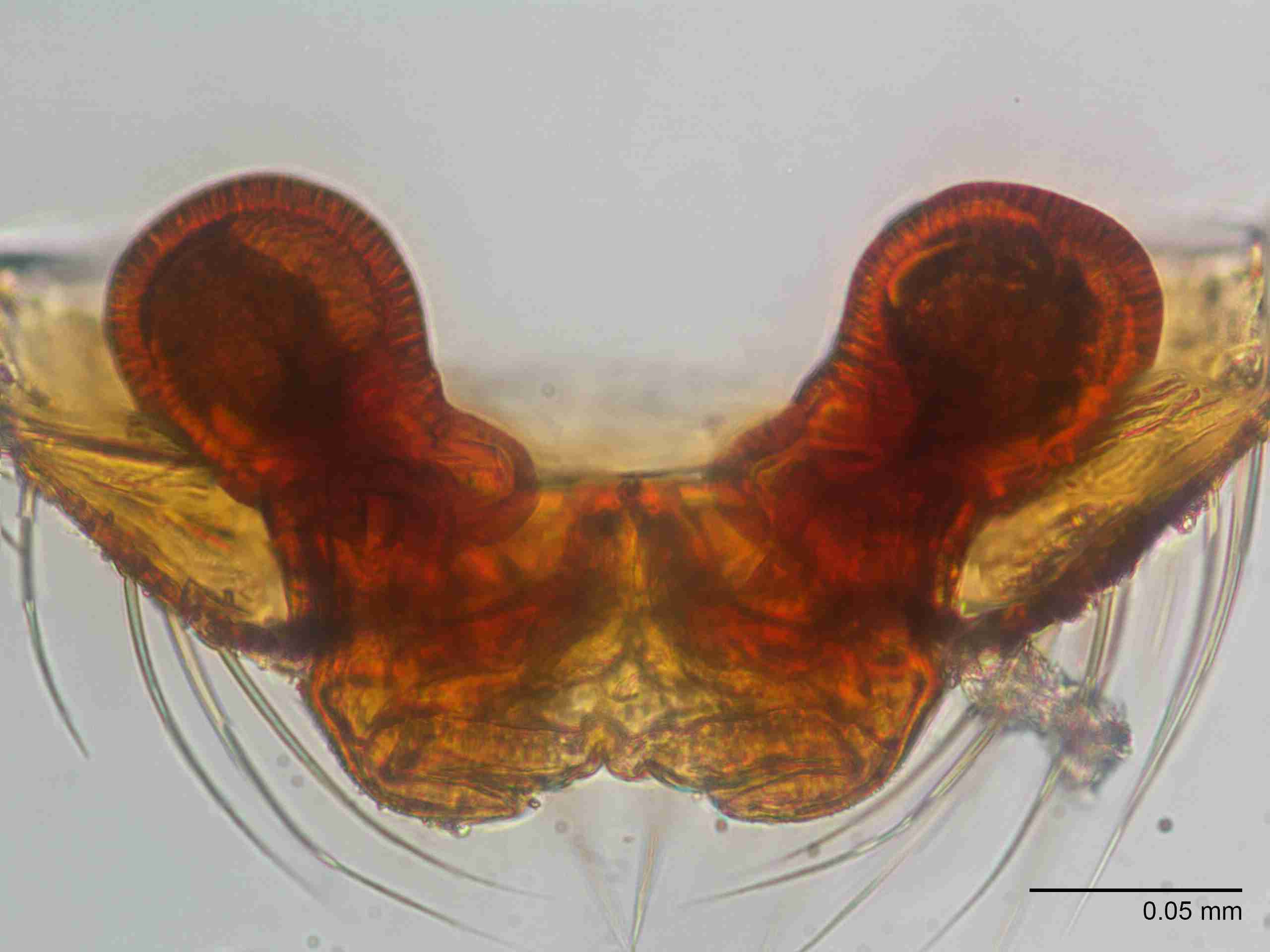 XILLINY072fpepidJAM901_400X_E2A.jpg