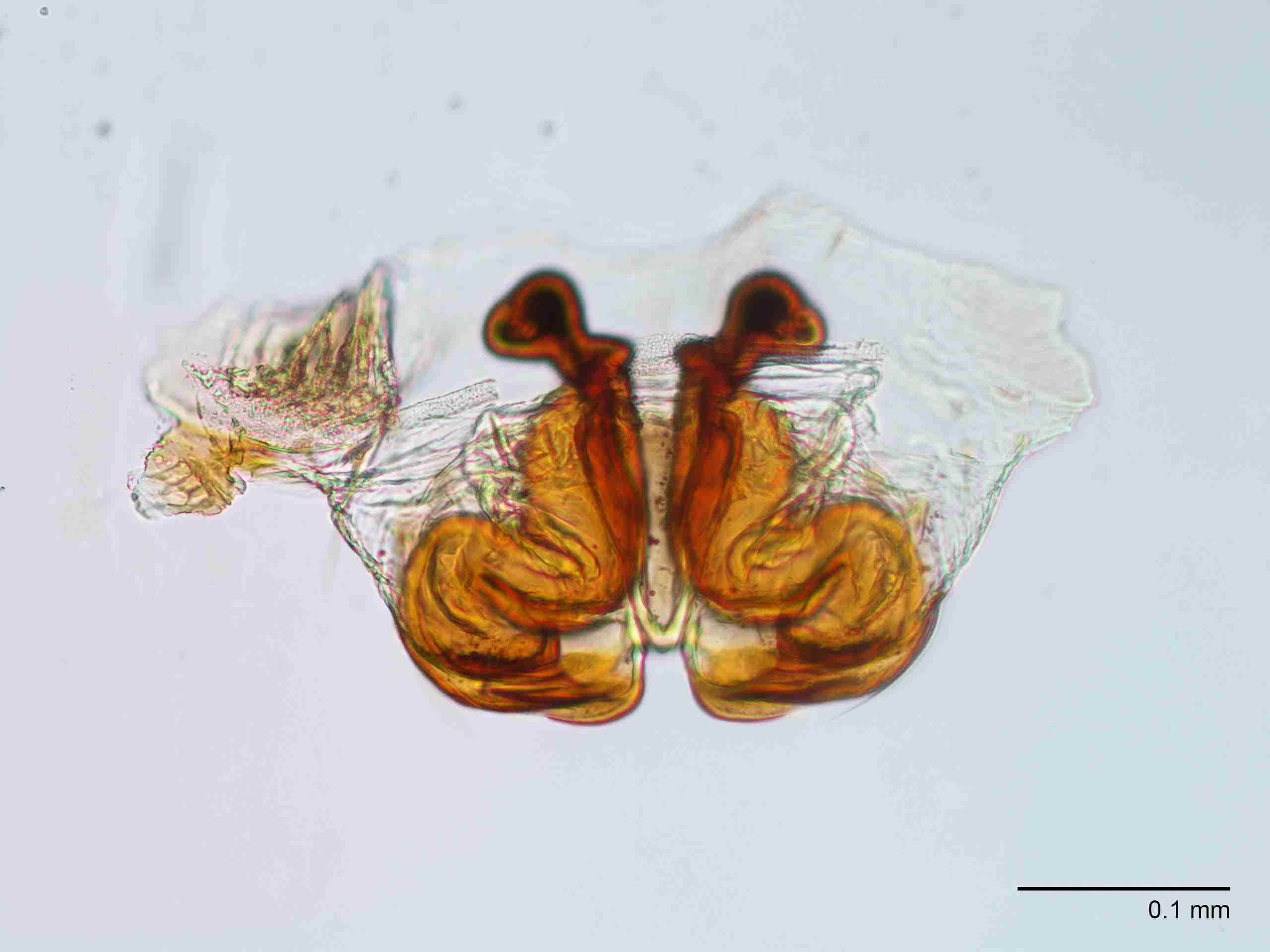 XILLINY073fpepidJAM902_200X_CAS.jpg