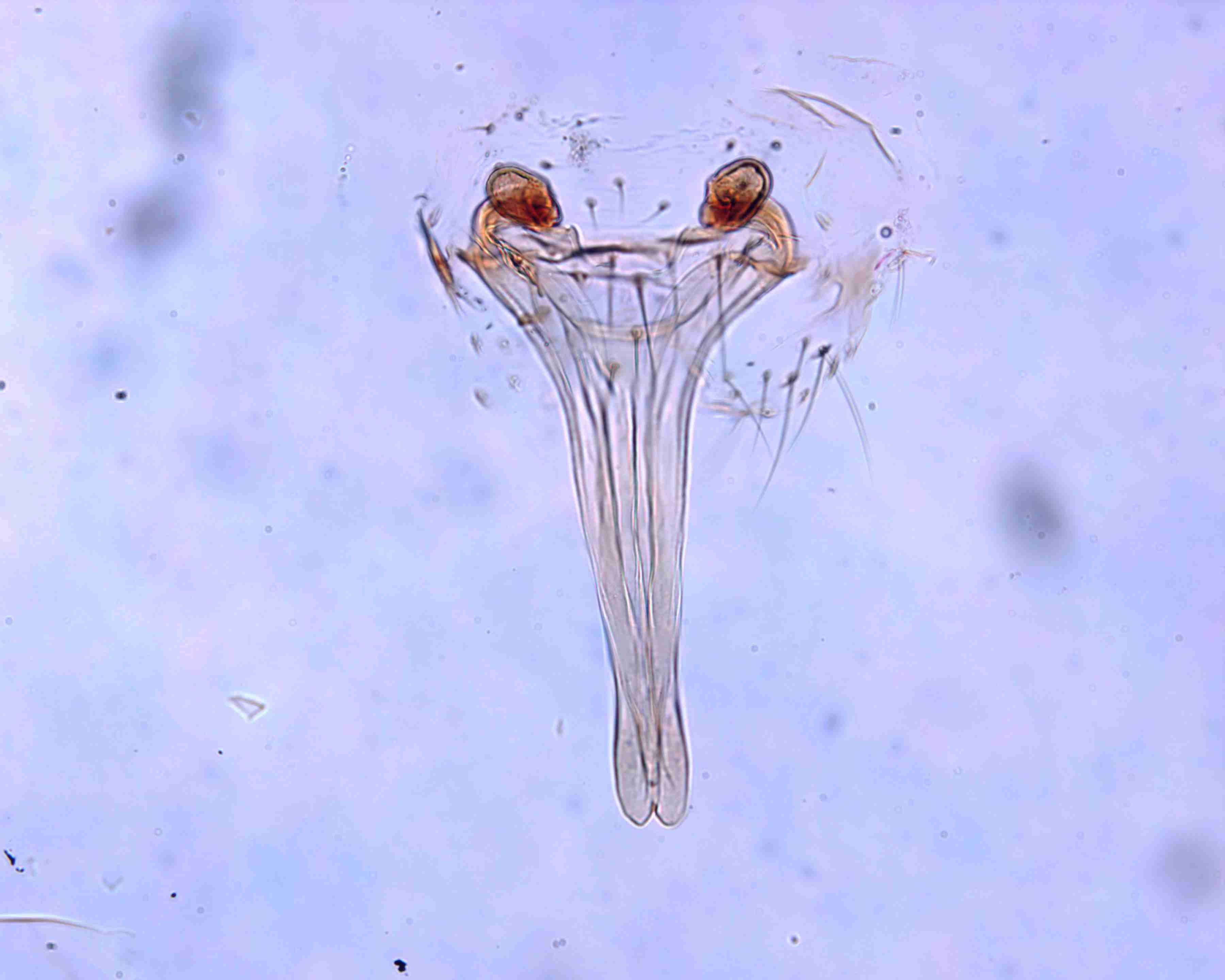XILLINY074fpepidJAM340_200X_CAS.jpg