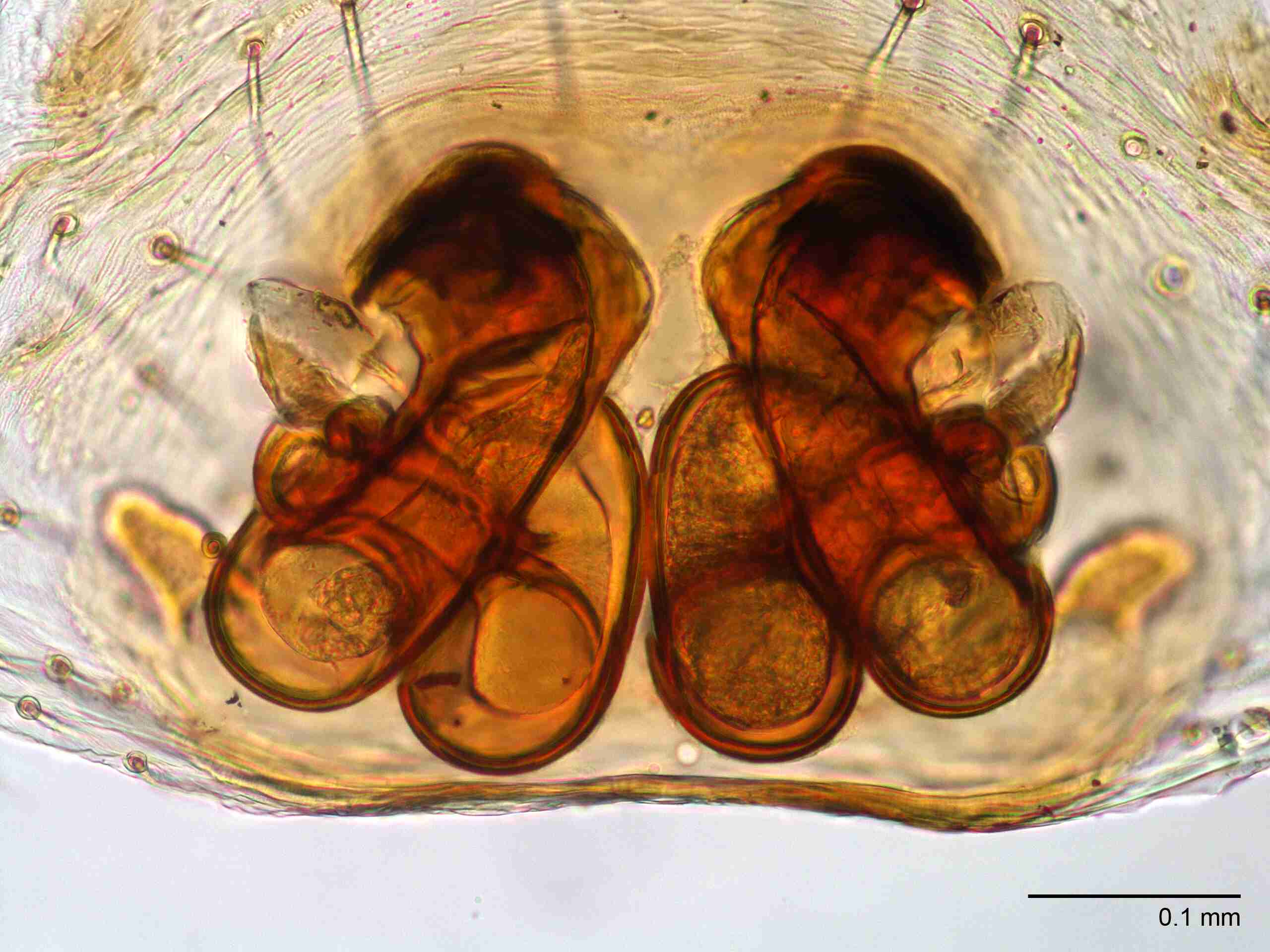 XILSALT118fpepidJAM867_200X_CAS.jpg