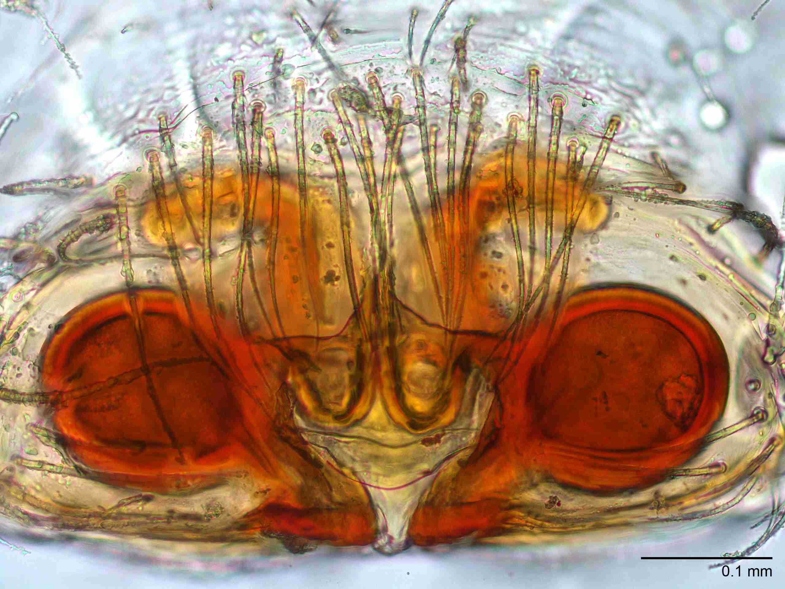 XILSALT103fpepivJAM046_200X_CAS.jpg