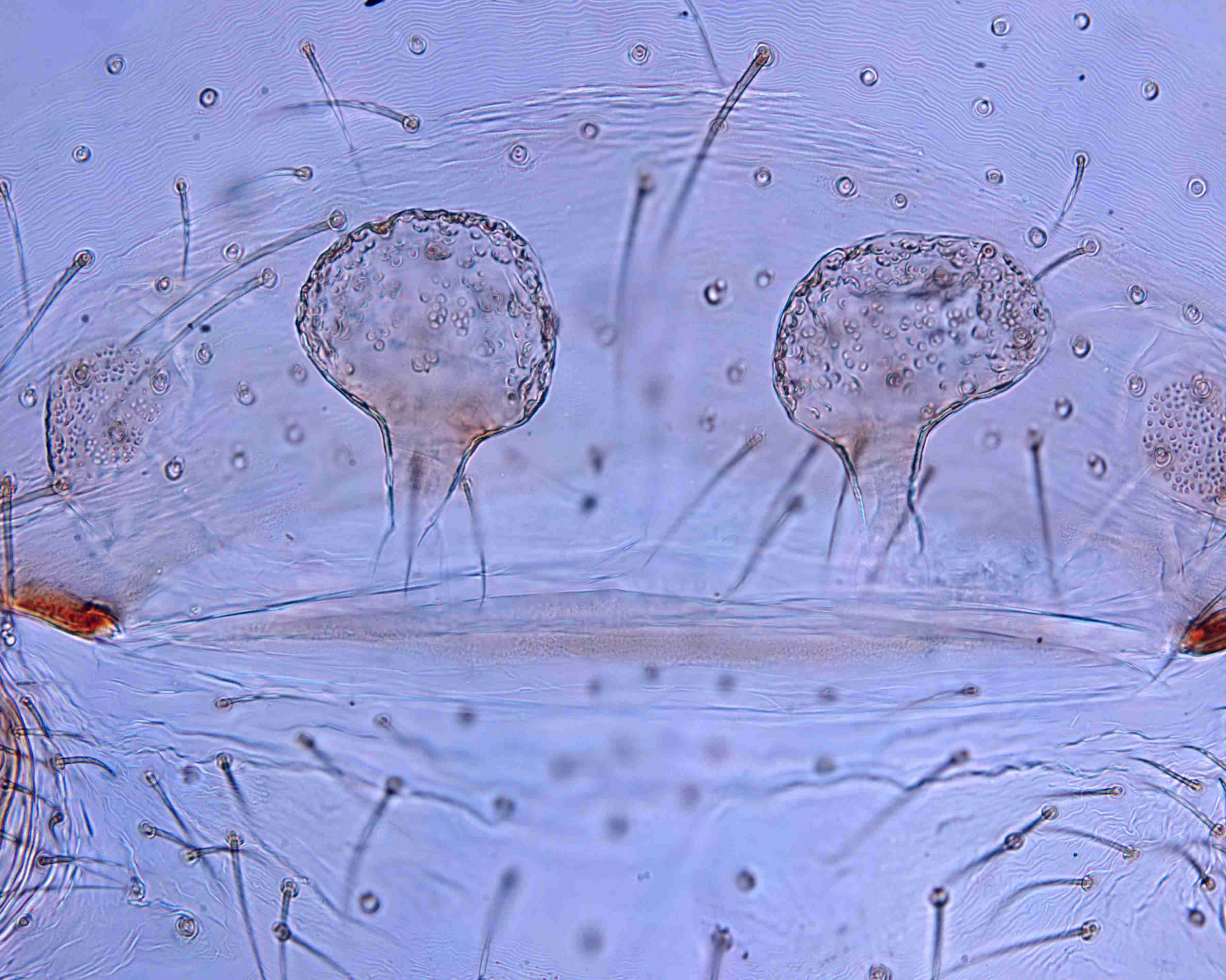 XILSCYT121fpepidJAM307_200X_CAS.jpg