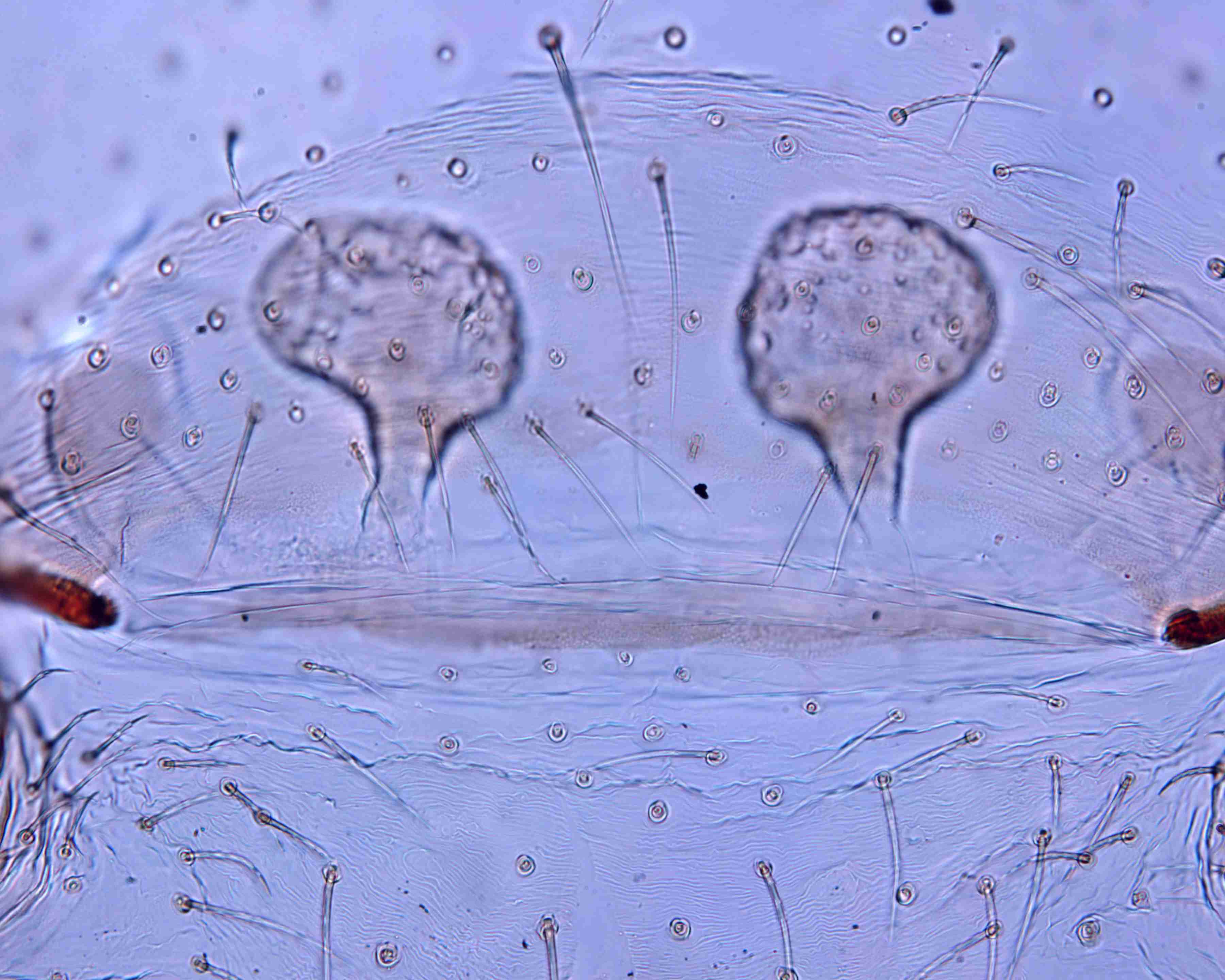 XILSCYT121fpepivJAM307_200X_CAS.jpg