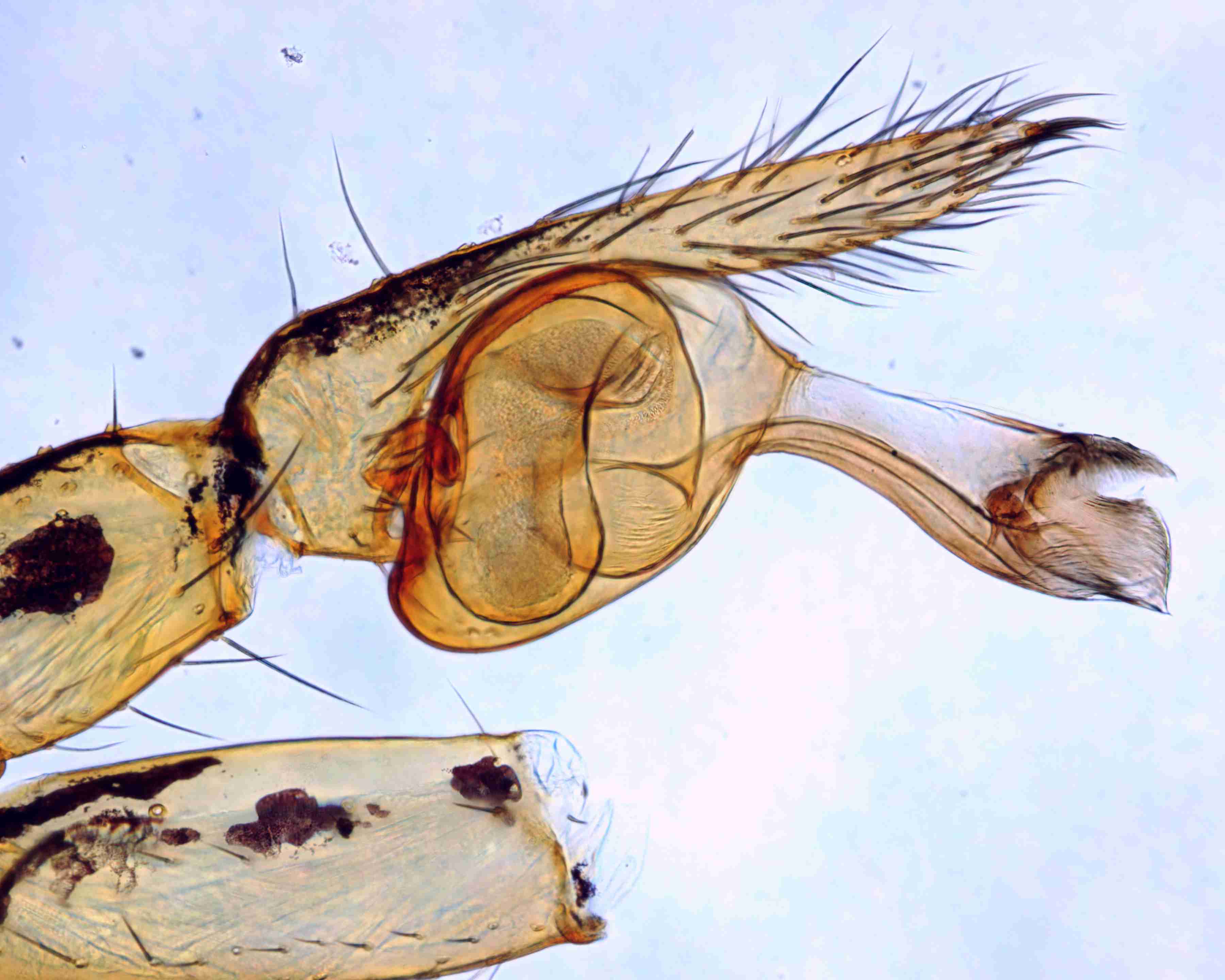 XILSCYT121mppalpJAM307_200X_CAS.jpg