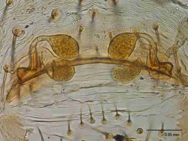 XILSCYT122fpepidJAM894_400X_E2A.jpg