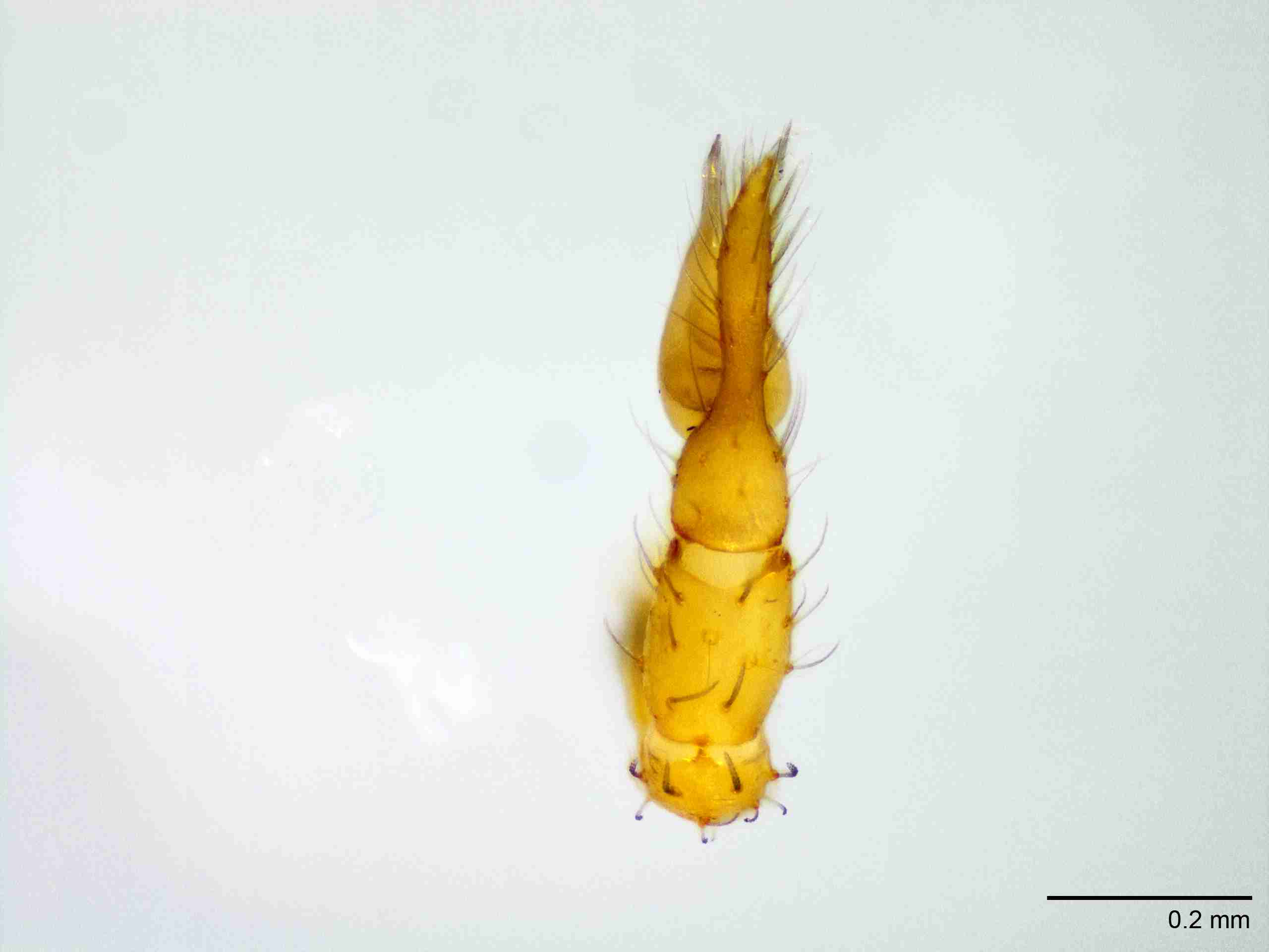 XILSCYT122mppaldJAM893_100X_E2A.jpg