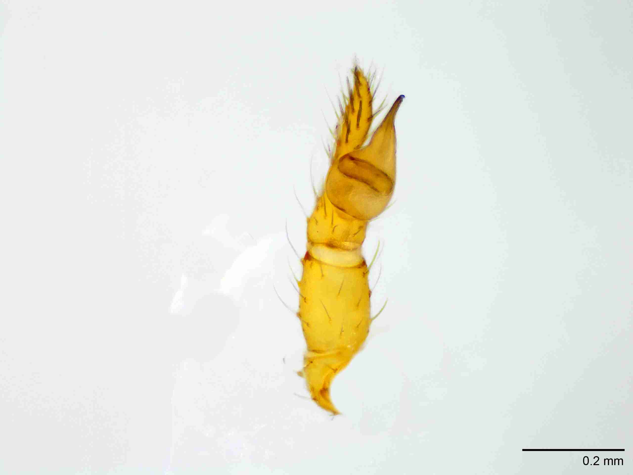 XILSCYT122mppalvJAM893_100X_E2A.jpg