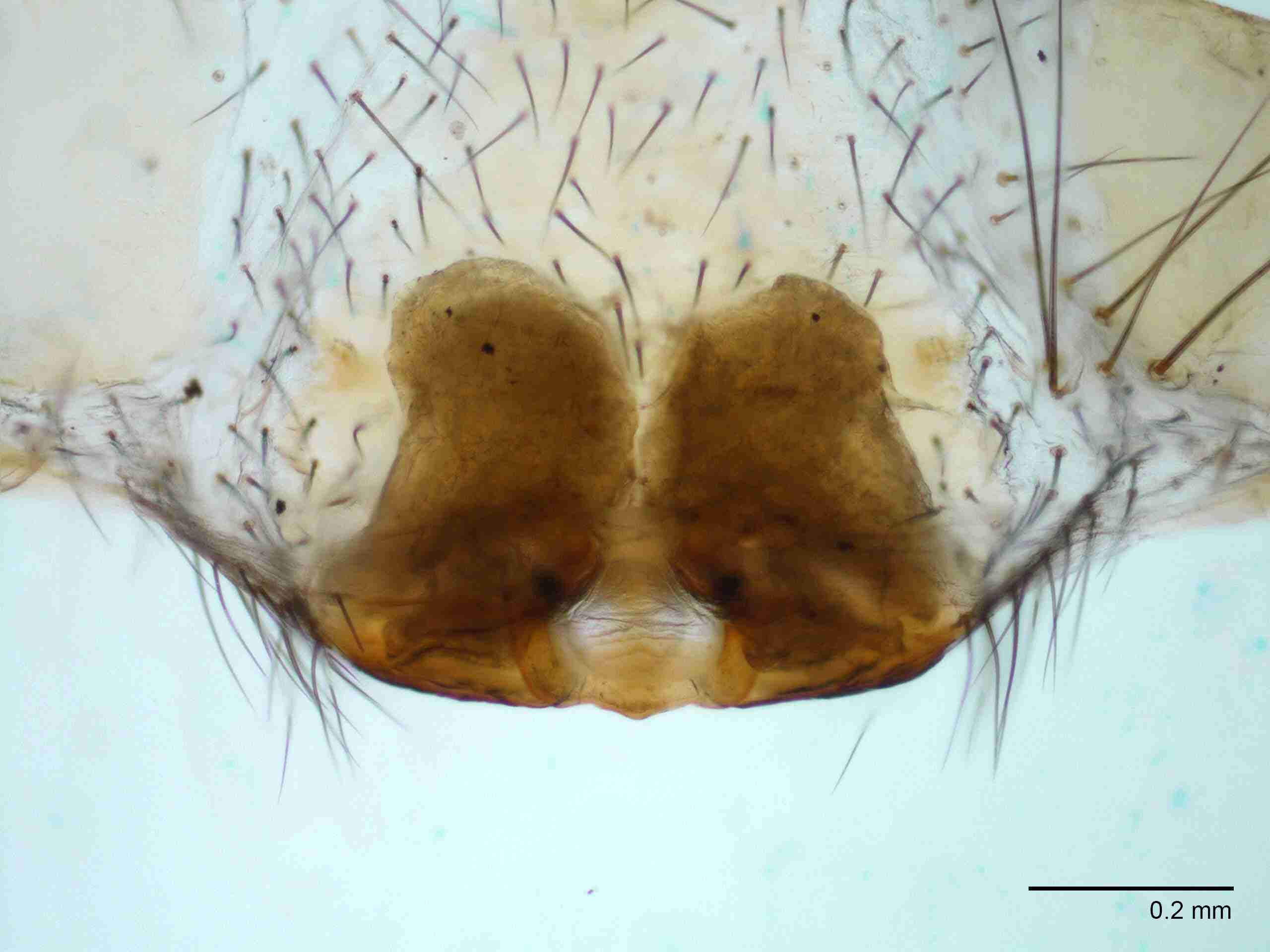 XILTETR128fpepidJAM874_100X_E2A.jpg