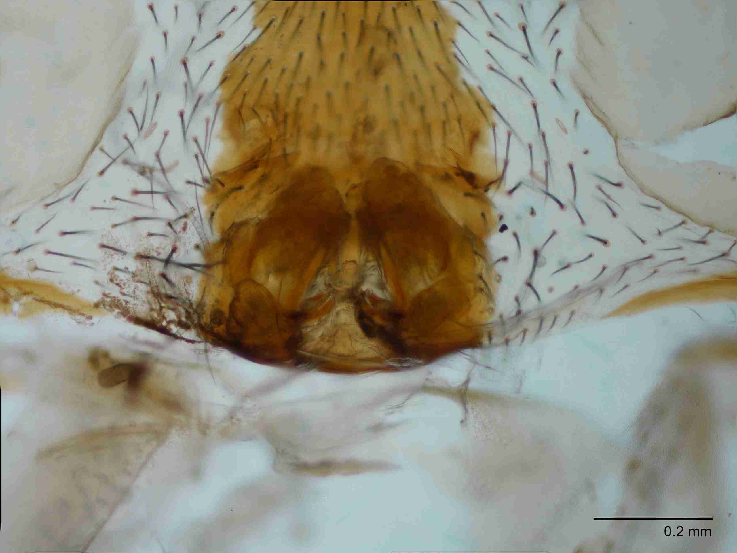 XILTETR129fpepidJAM872_100X_E2A.jpg