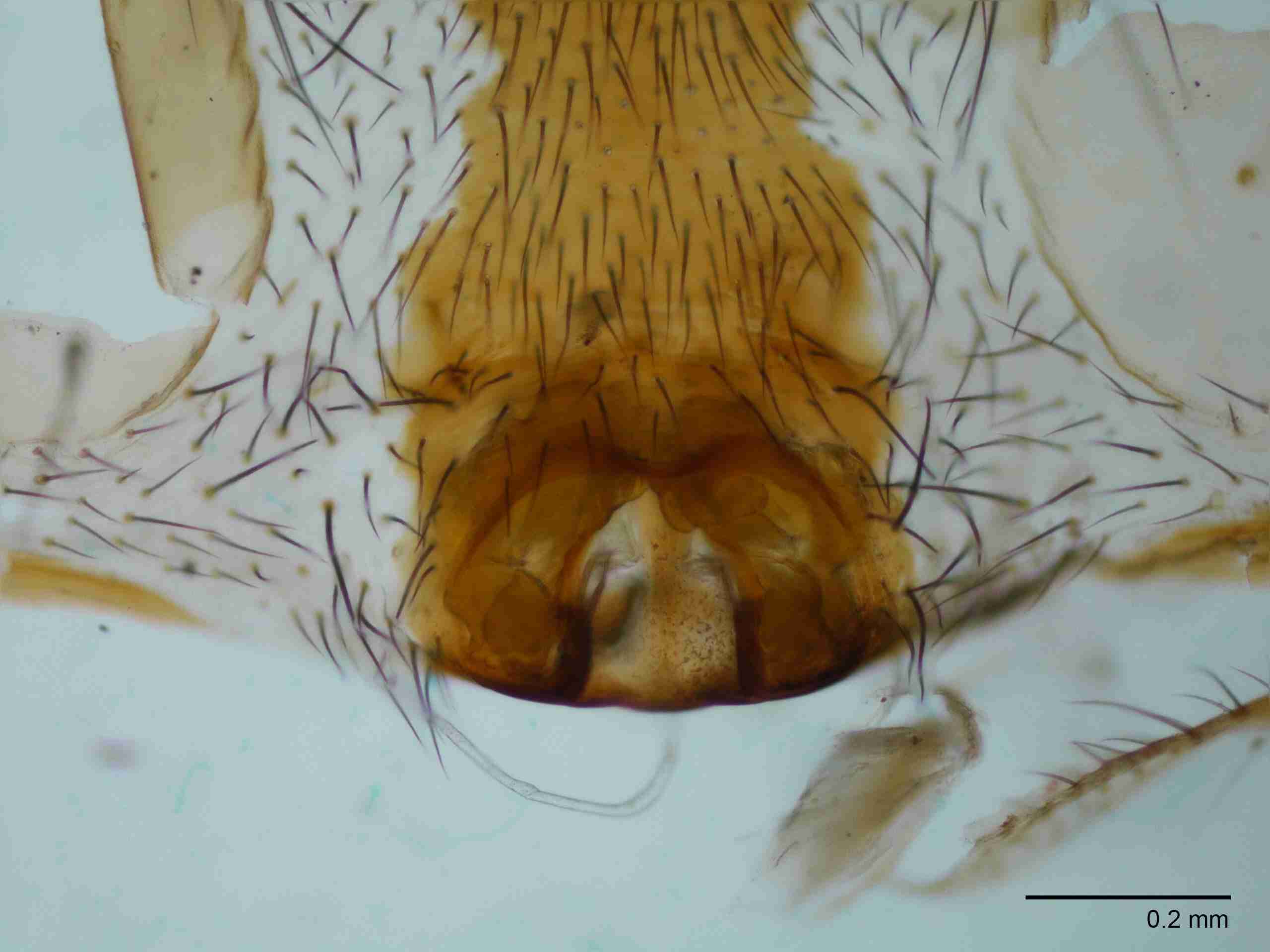 XILTETR129fpepivJAM872_100X_E2A.jpg