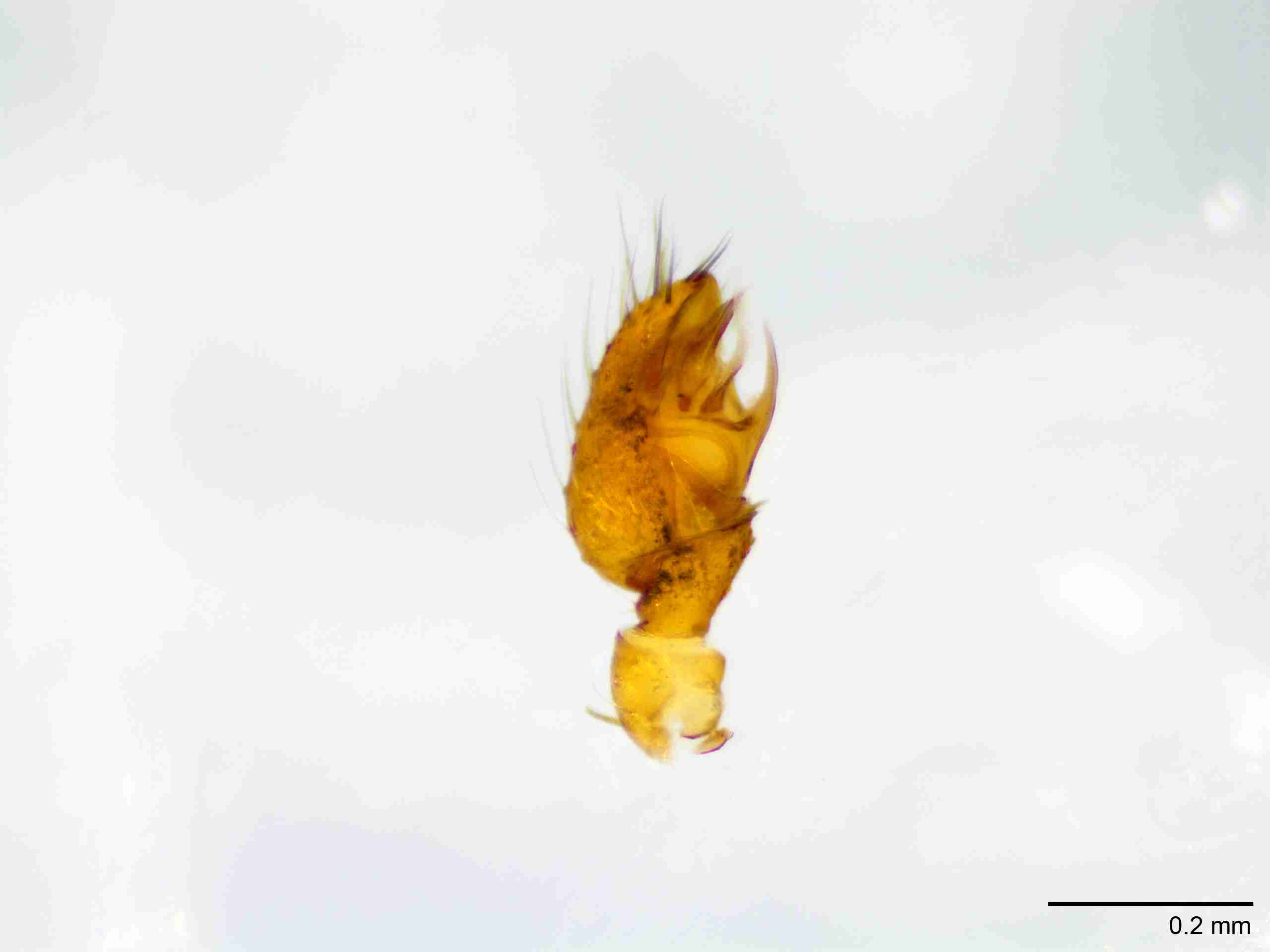 XILTHER130mppalpJAM079_100X_E2A.jpg