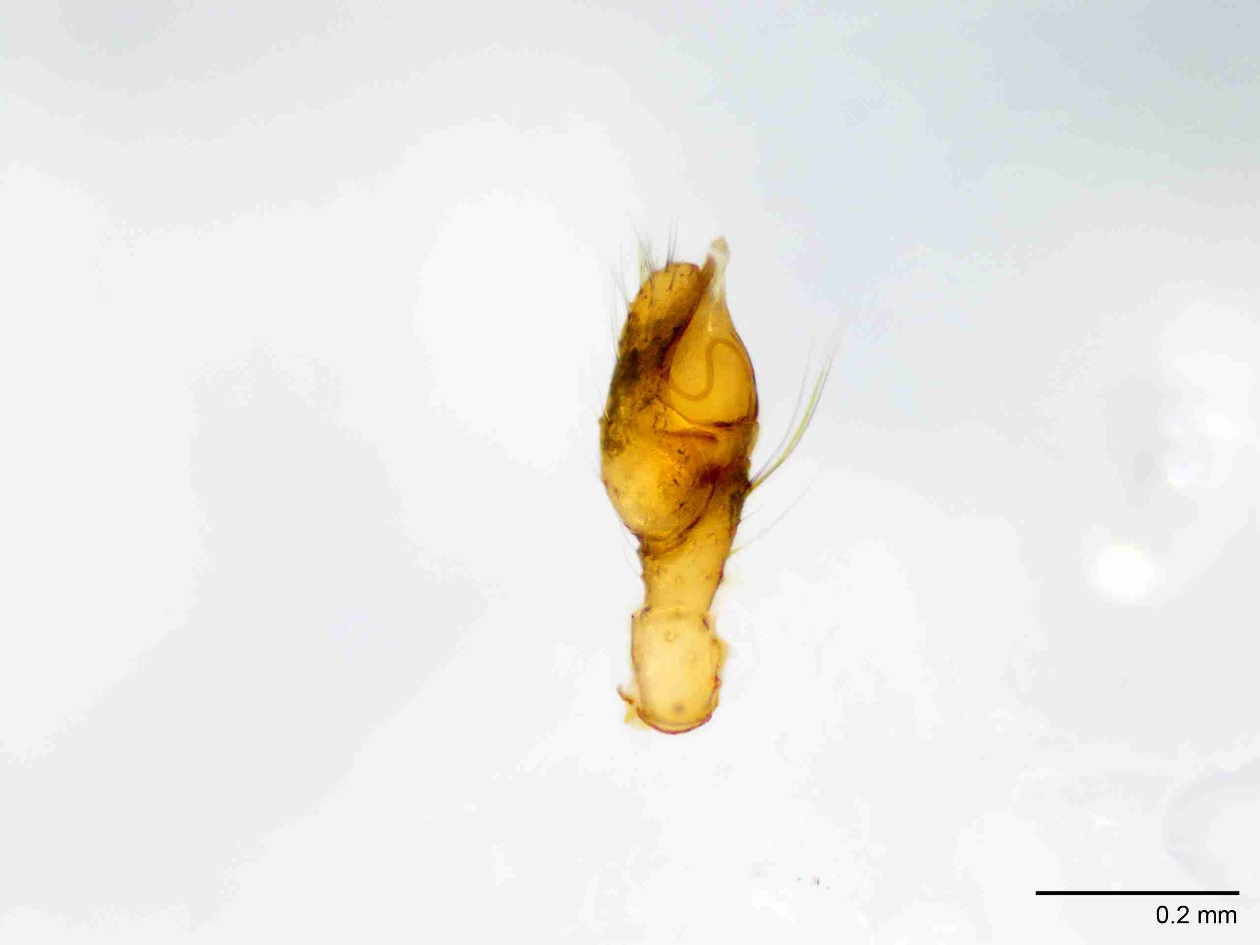 XILTHER131mppalpJAM186_100X_E2A.jpg