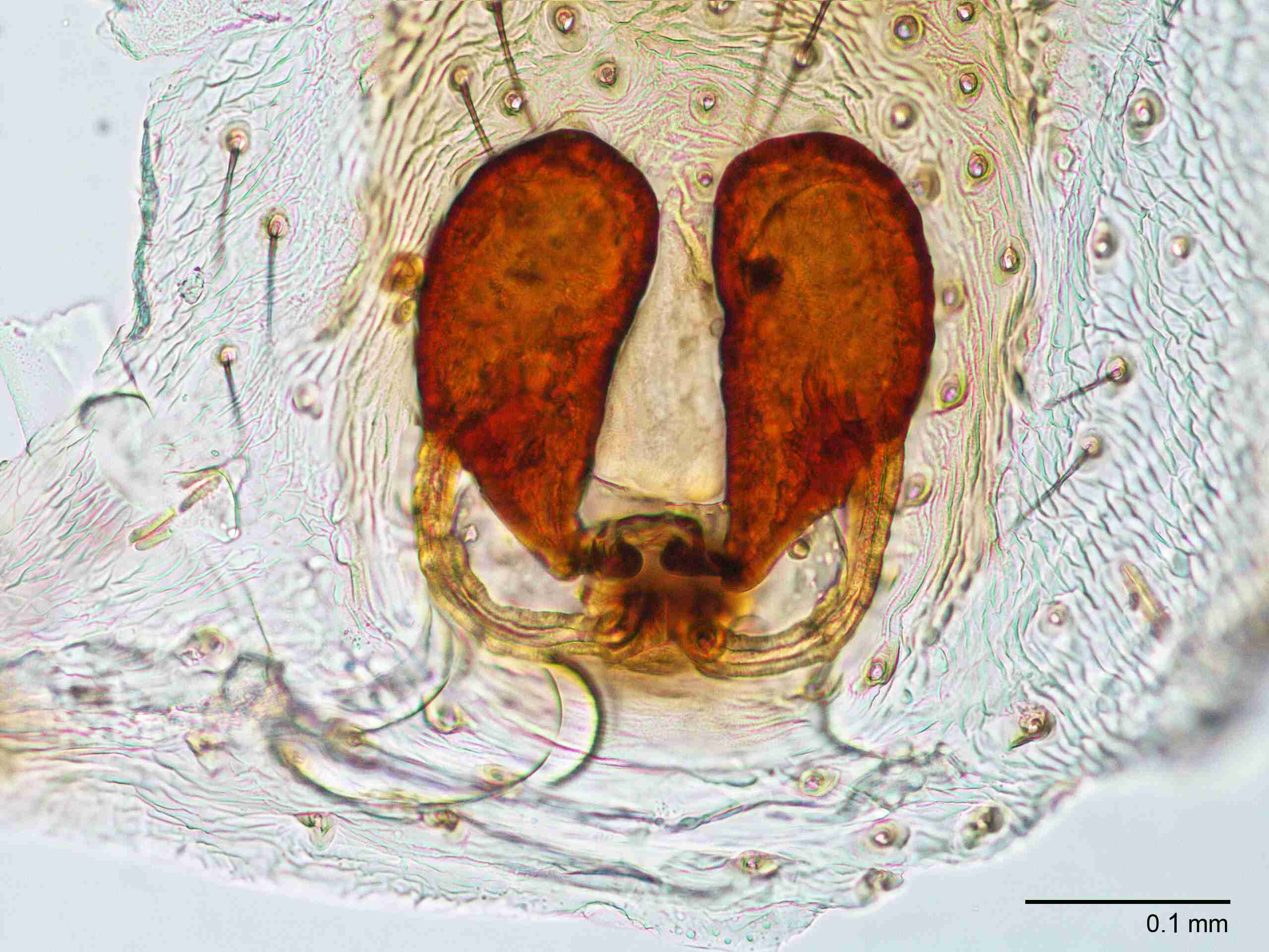 XILTHER135fpepidJAM514_200X_CAS.jpg