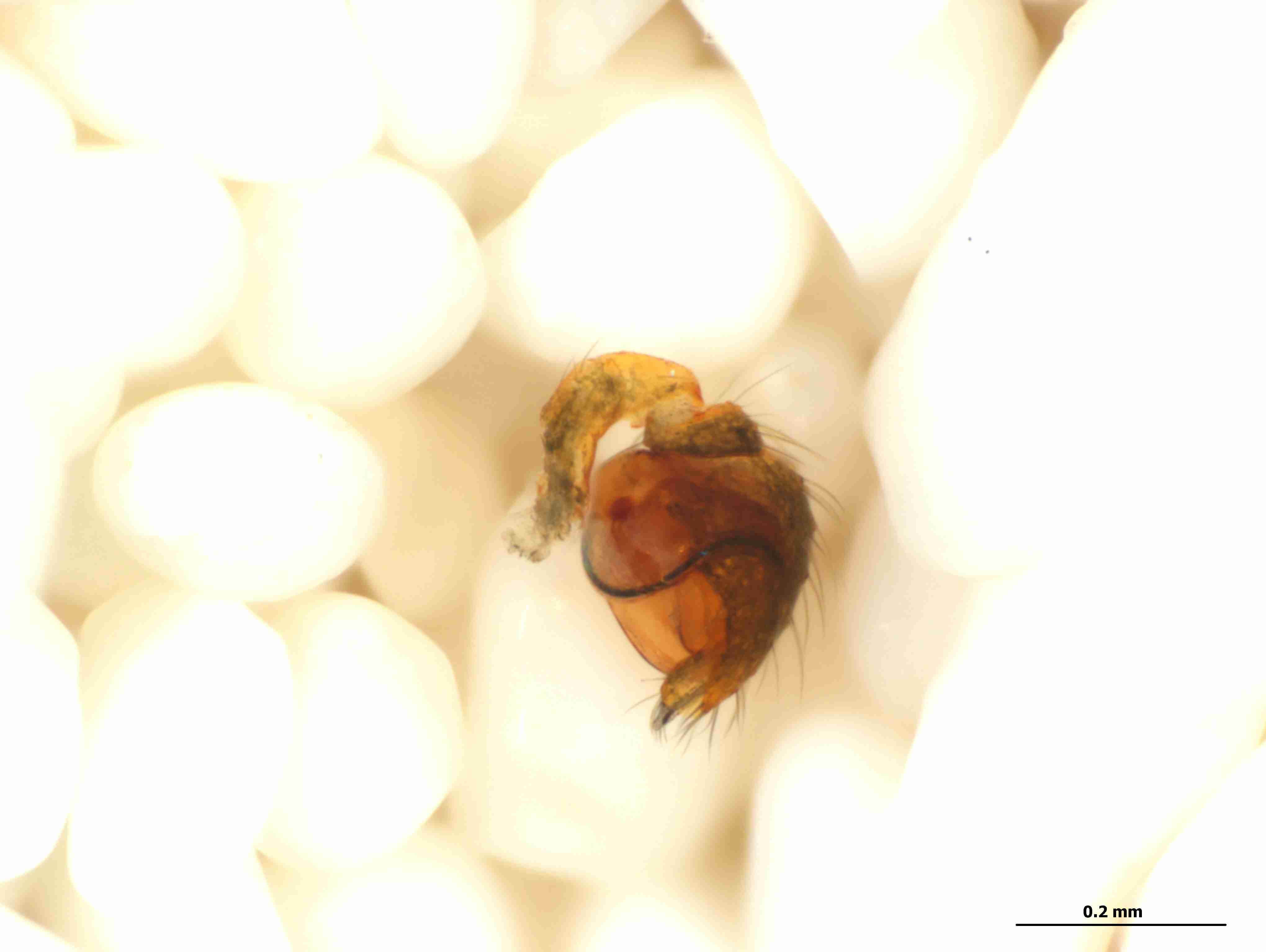 XILTHER136mppalpJAM302_115X_CAS.jpg