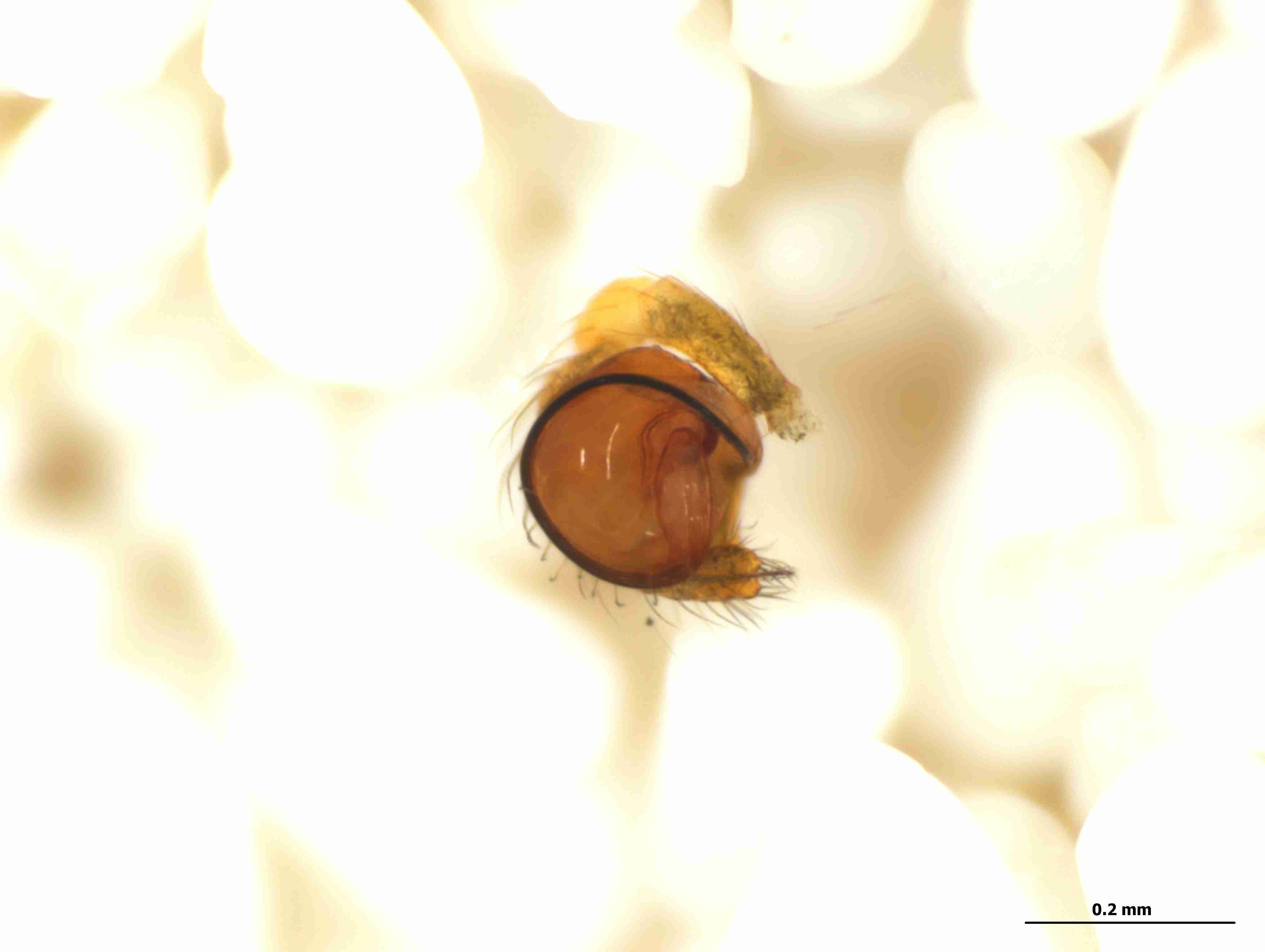 XILTHER136mppalvJAM302_115X_CAS.jpg