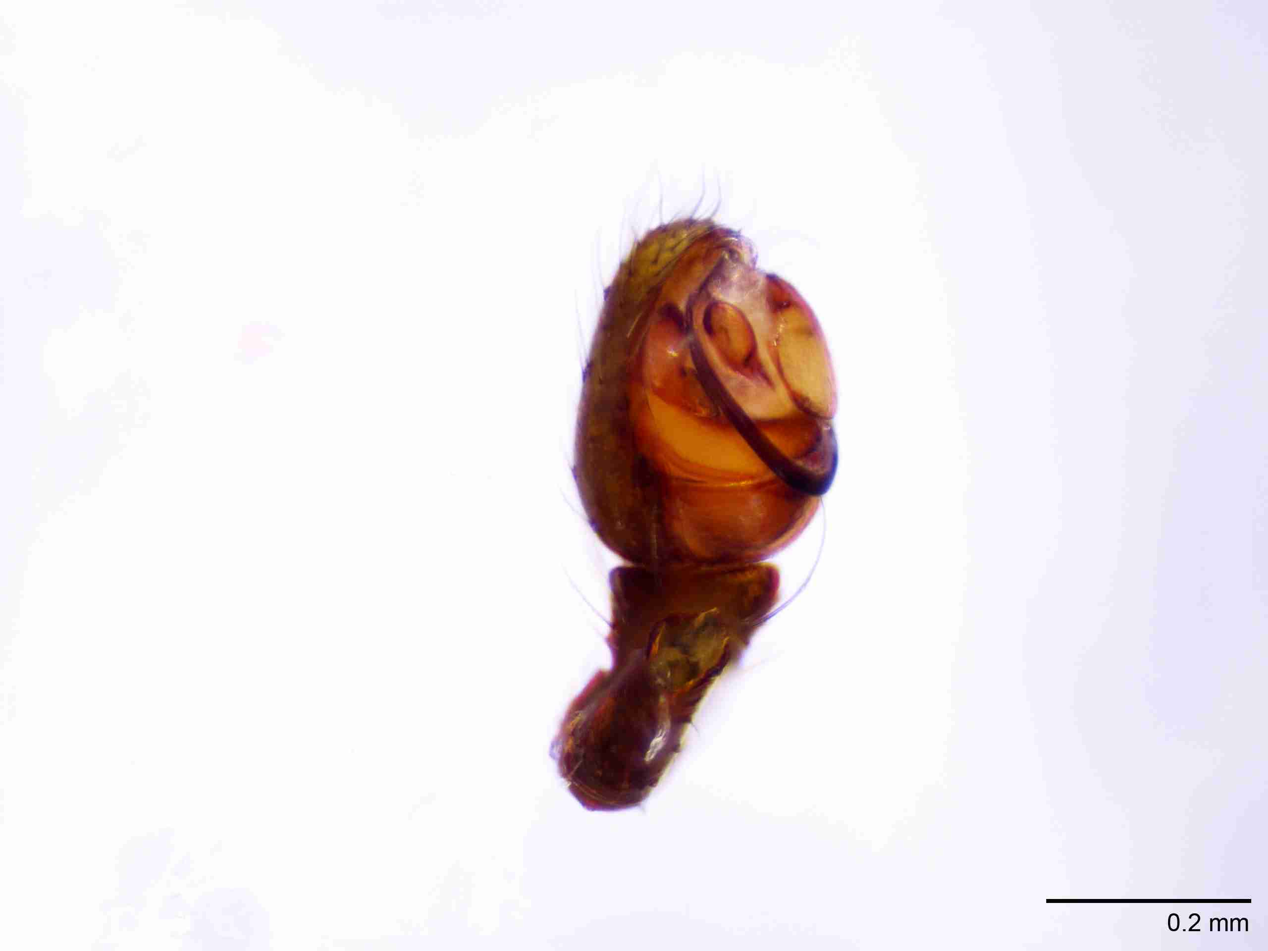 XILTHER138mppalpJAM092_100X_E2A.jpg