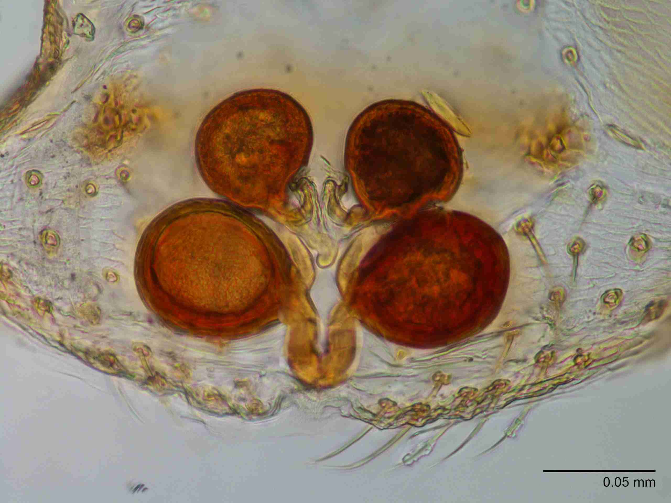 XILTHER143fpepidJAM205_400X_E2A.jpg