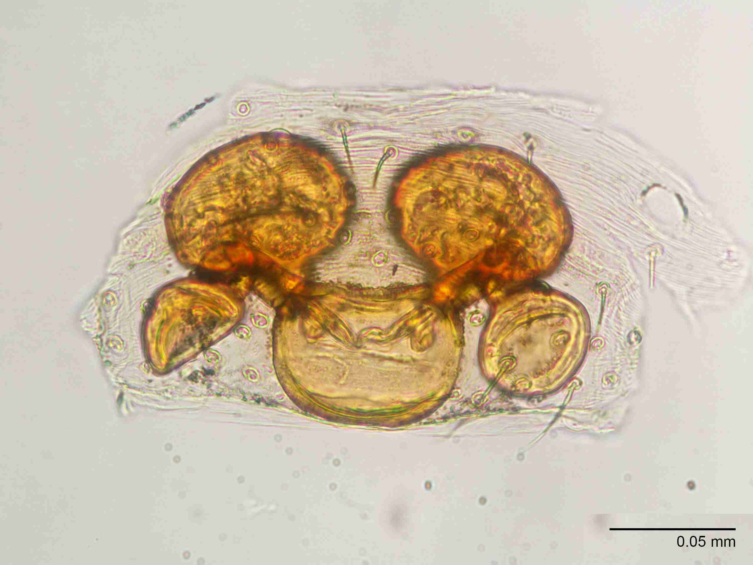 XILTHER144fpepidJAM515_400X_E2A.jpg