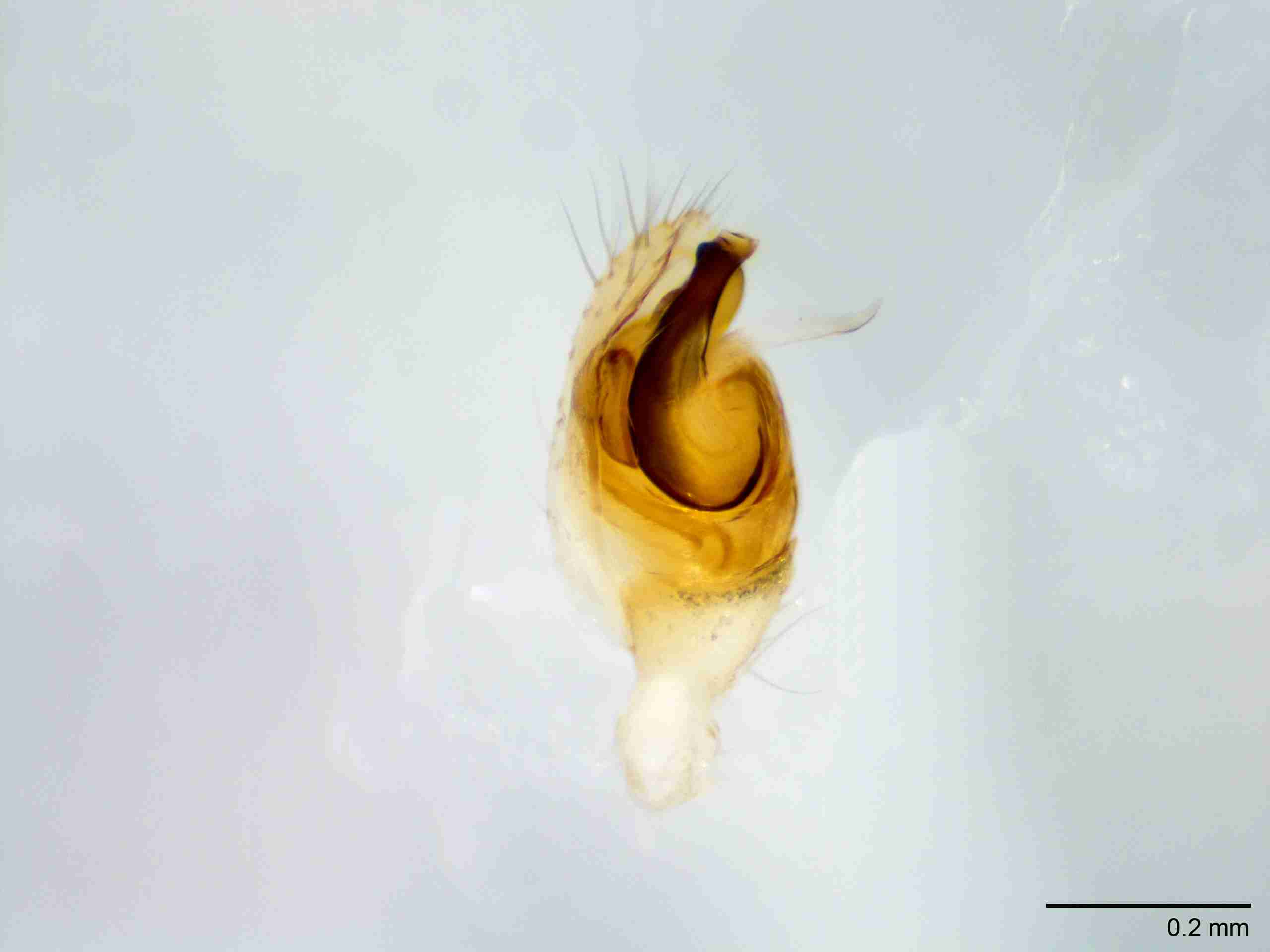 XILTHER145mppalpJAM516_100X_E2A.jpg