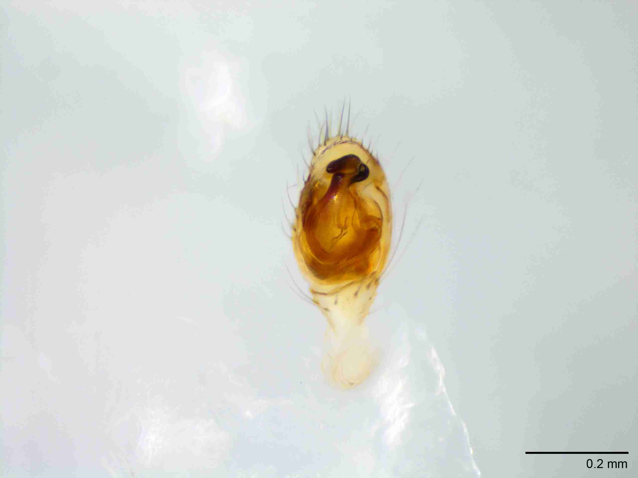 XILTHER146mppalvJAM227_100X_E2A.jpg