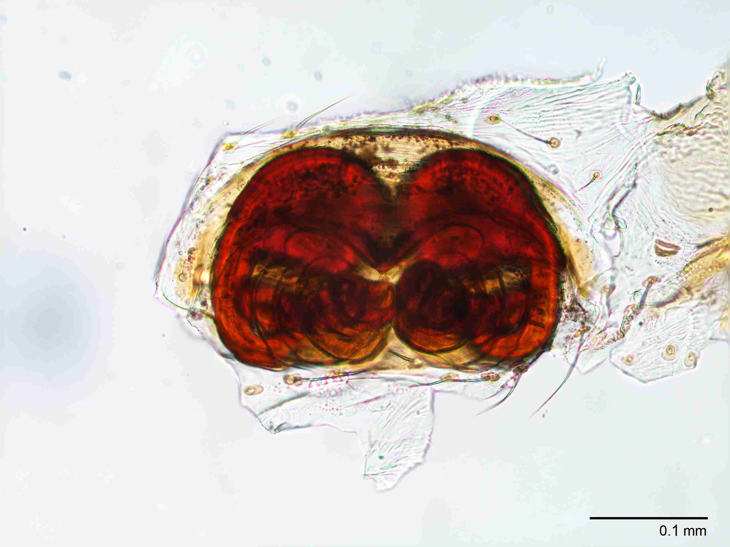 XILTHER147fpepivJAM142_200X_CAS.jpg