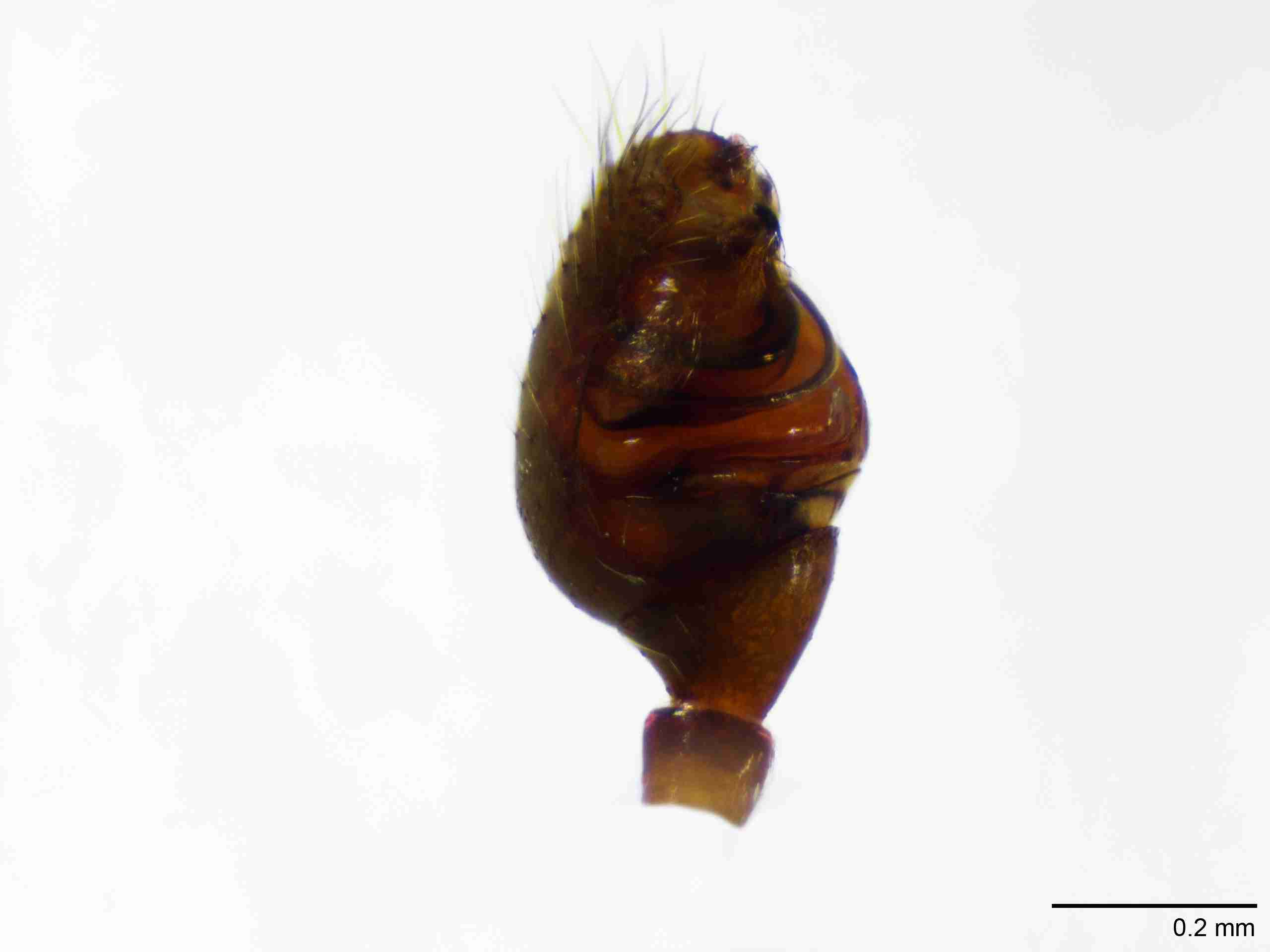 XILTHER147mppalpJAM093_100X_E2A.jpg