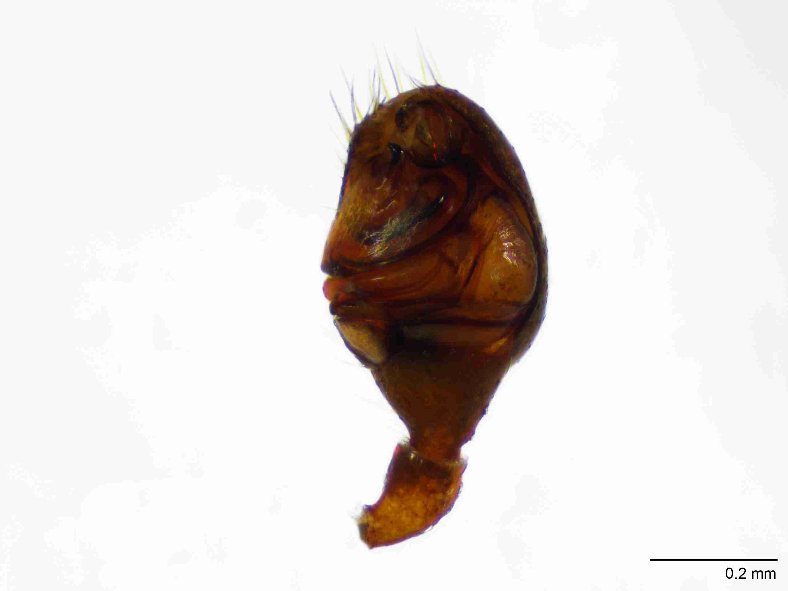 XILTHER147mppalvJAM093_100X_E2A.jpg