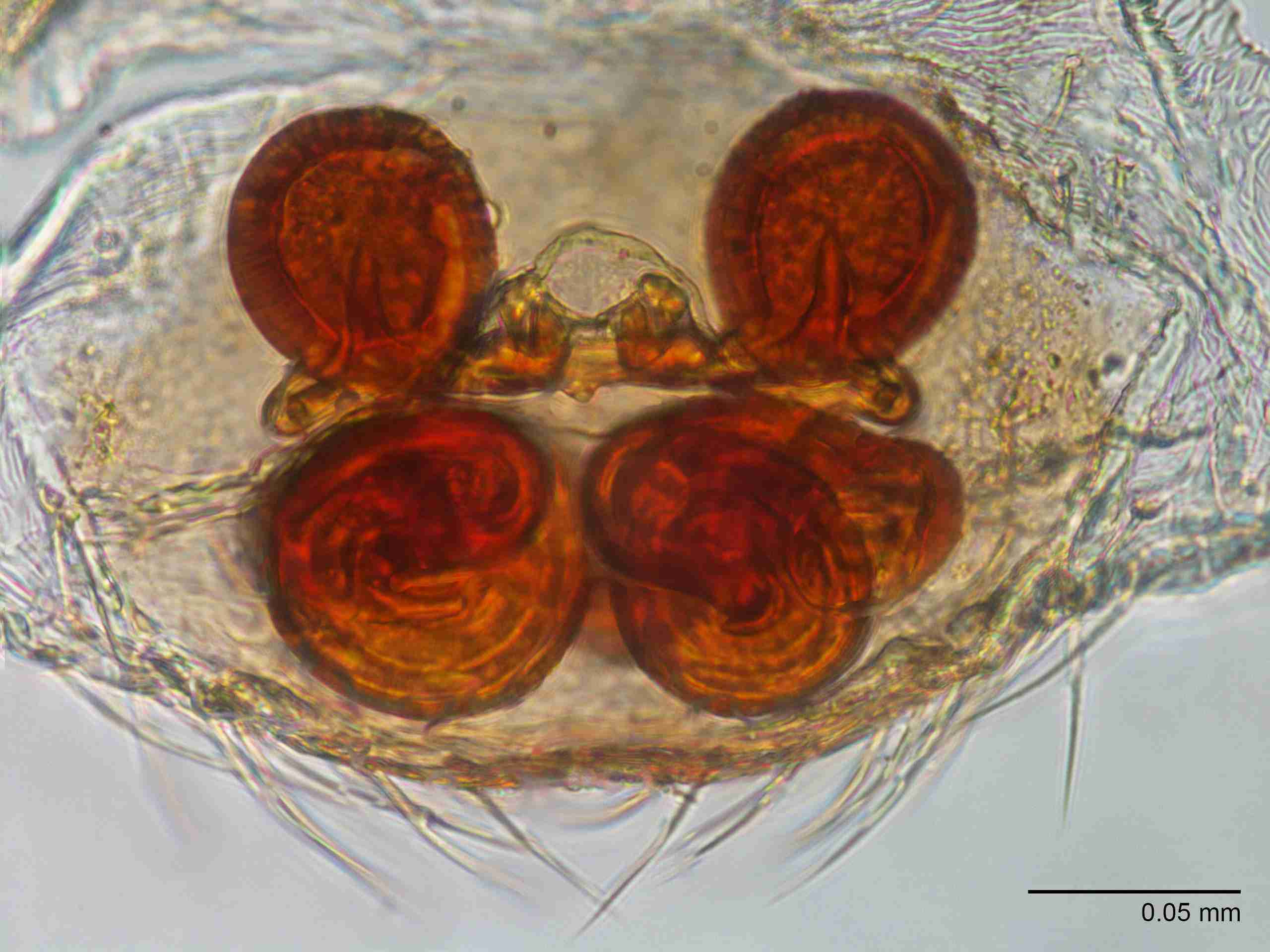 XILTHER148fpepidJAM095_400X_E2A.jpg