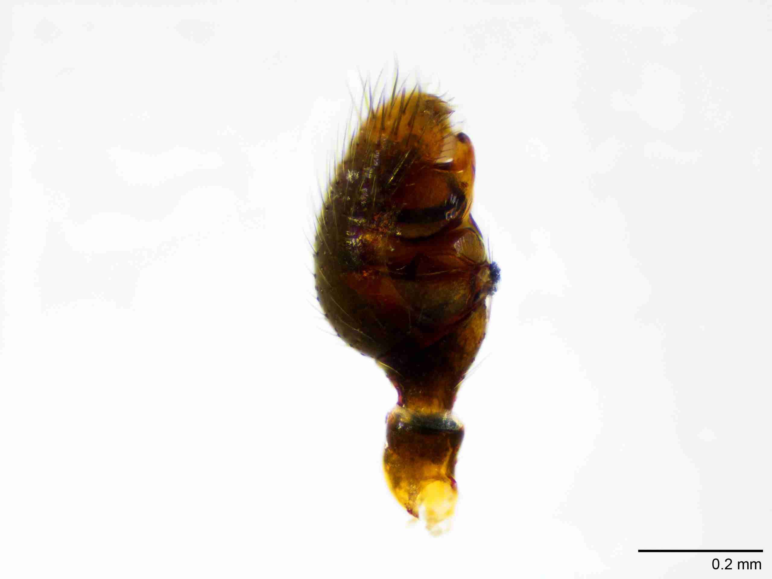 XILTHER148mppalpJAM411_100X_E2A.jpg