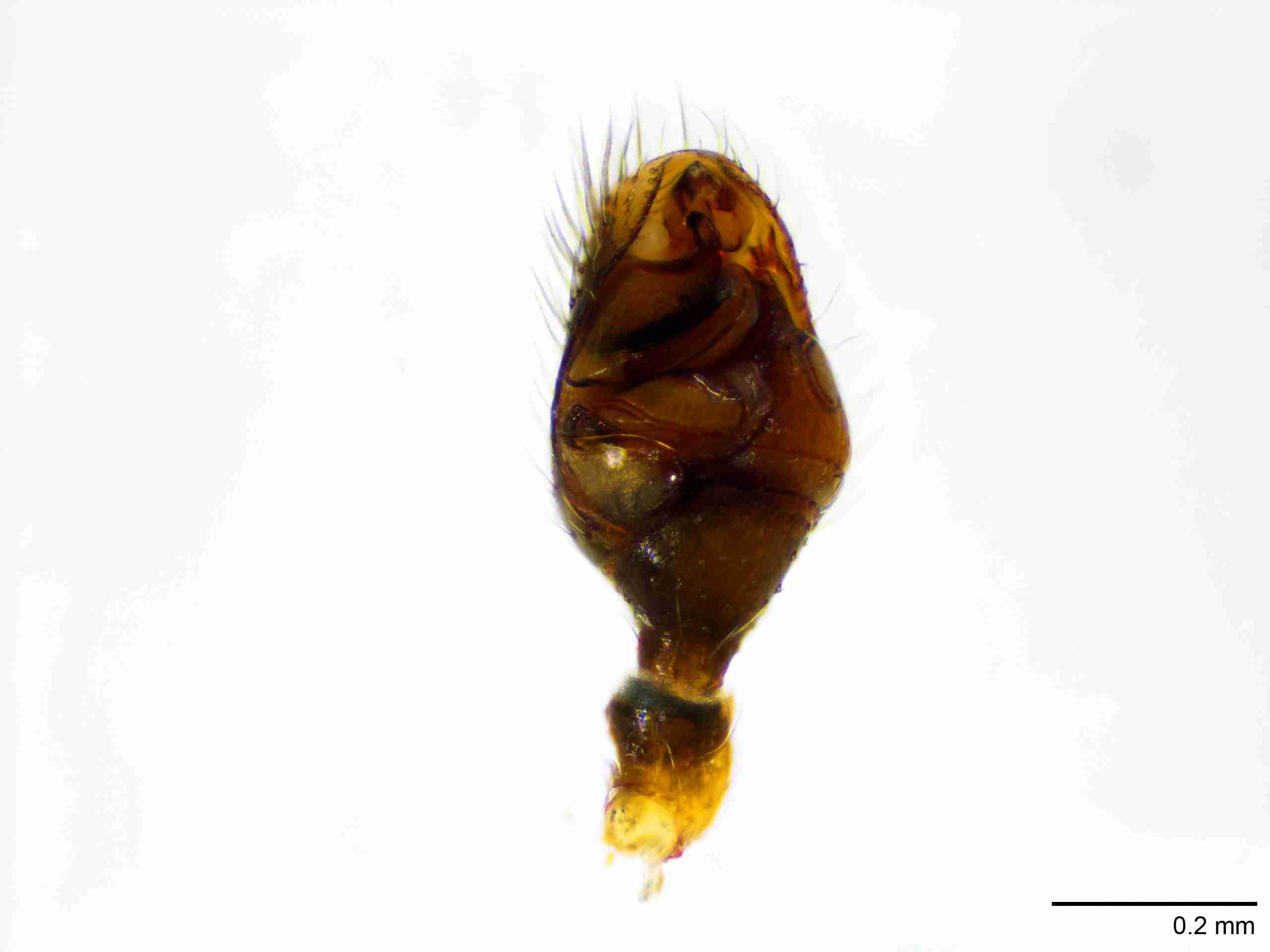 XILTHER148mppalvJAM411_100X_E2A.jpg