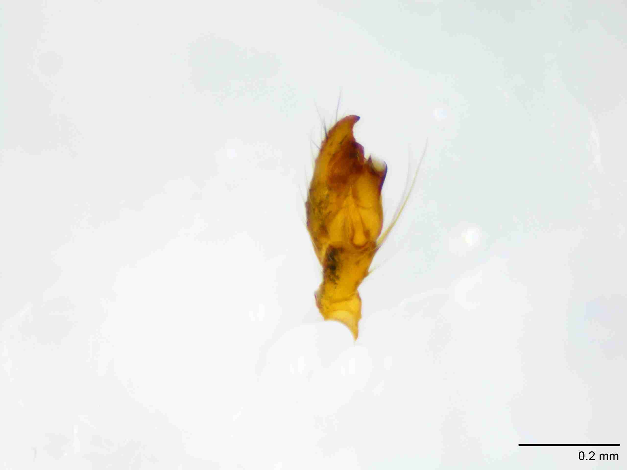 XILTHER149mppalpJAM138_100X_E2A.jpg