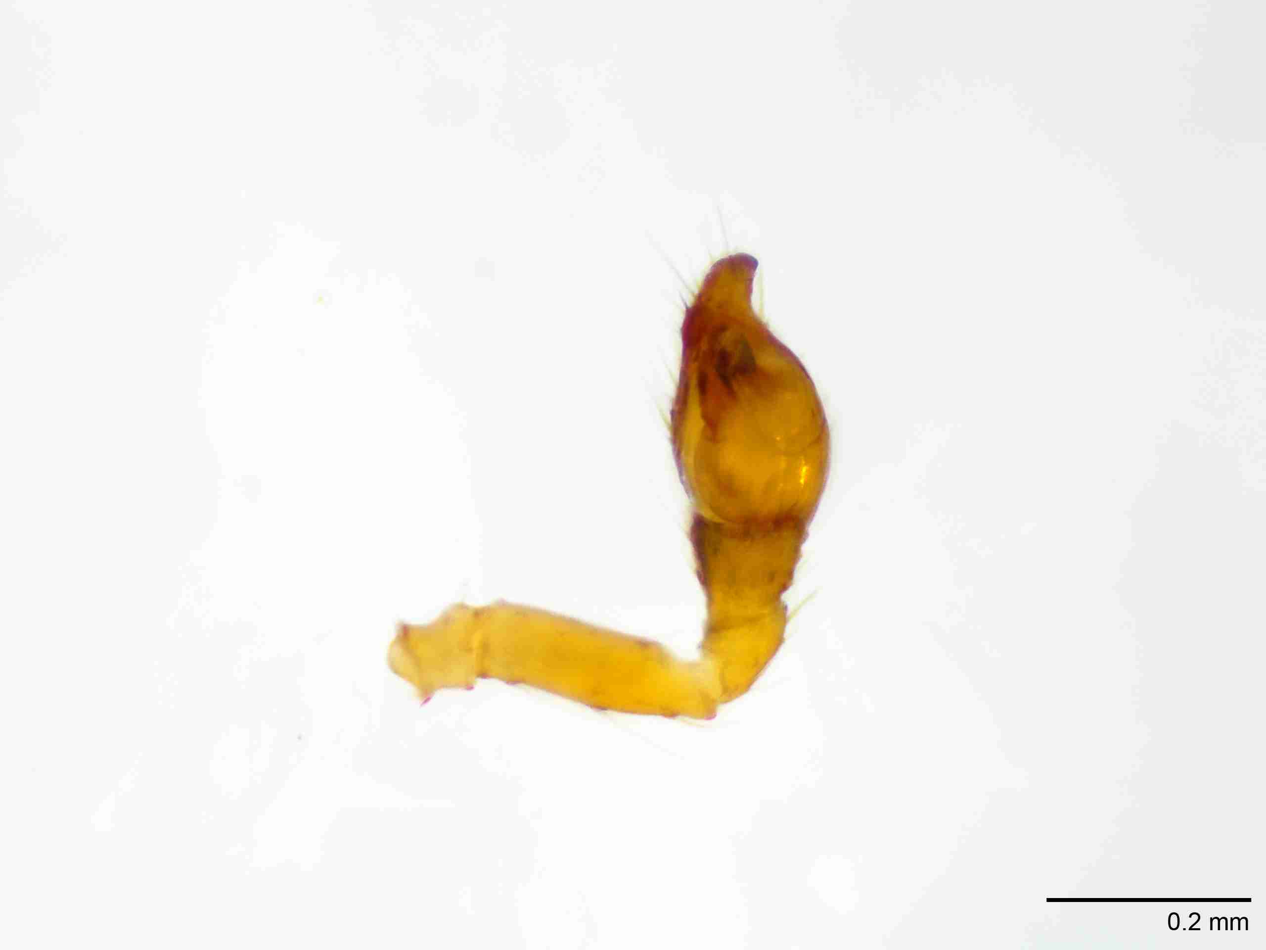 XILTHER149mppalvJAM138_100X_E2A.jpg