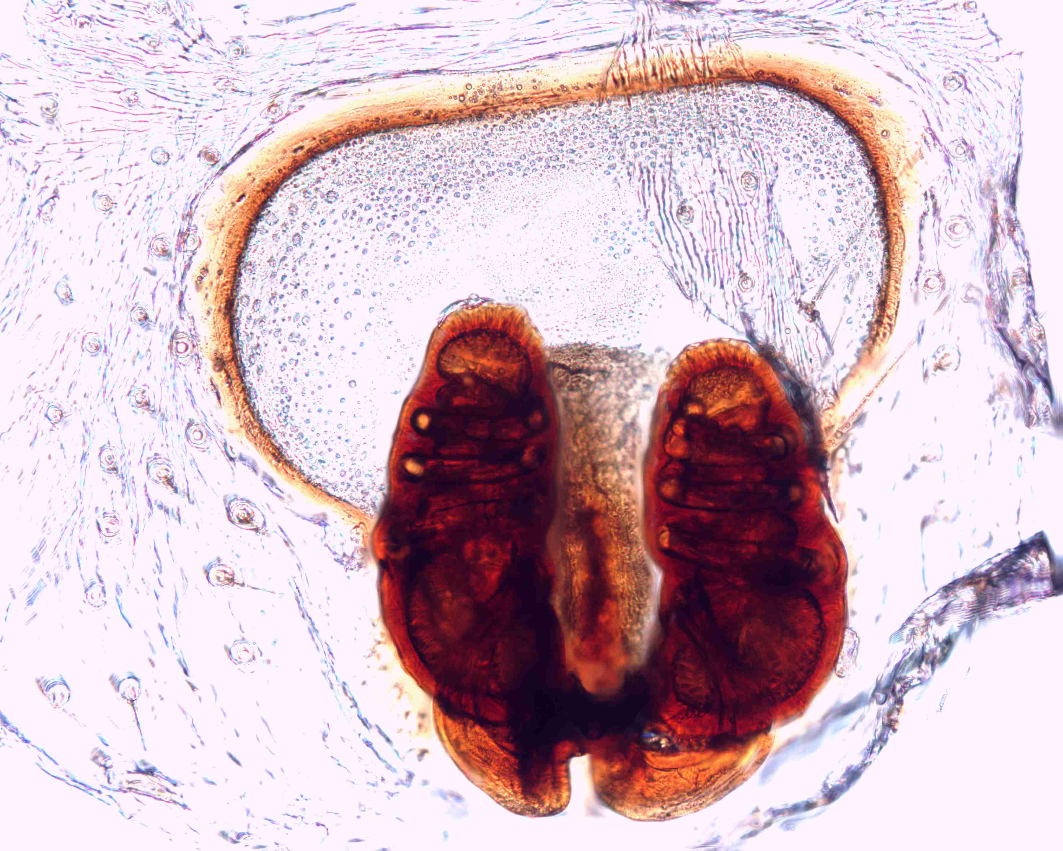 XILTHER150fpepidJAM313_200X_CAS.jpg