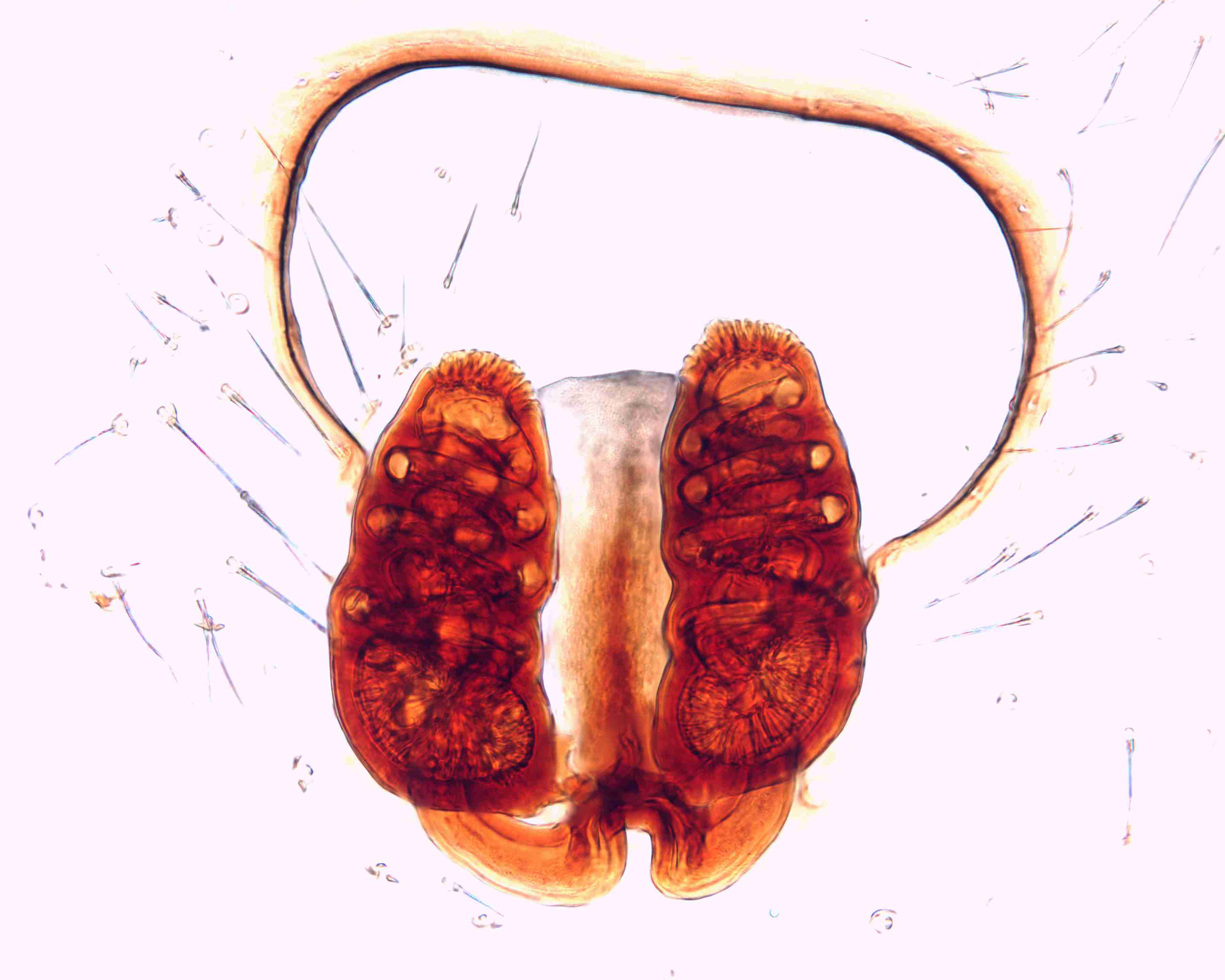 XILTHER150fpepivJAM313_200X_CAS.jpg
