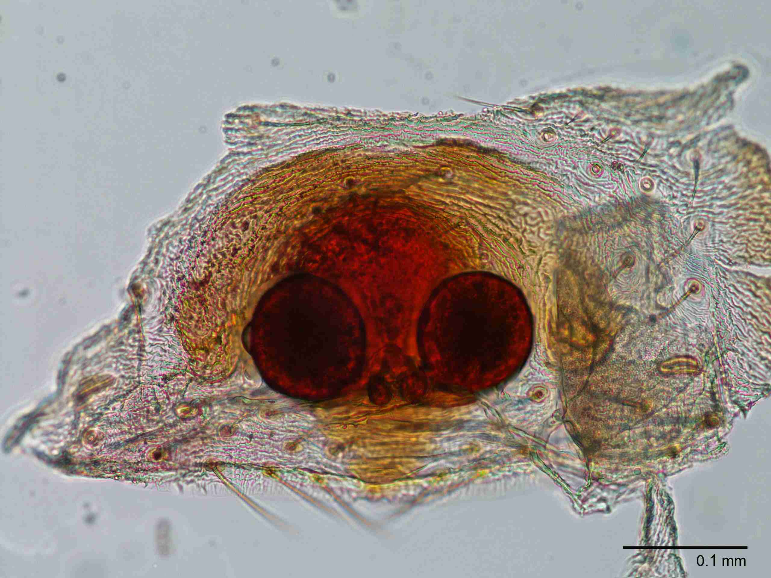 XILTHER151fpepidJAM426_200X_CAS.jpg