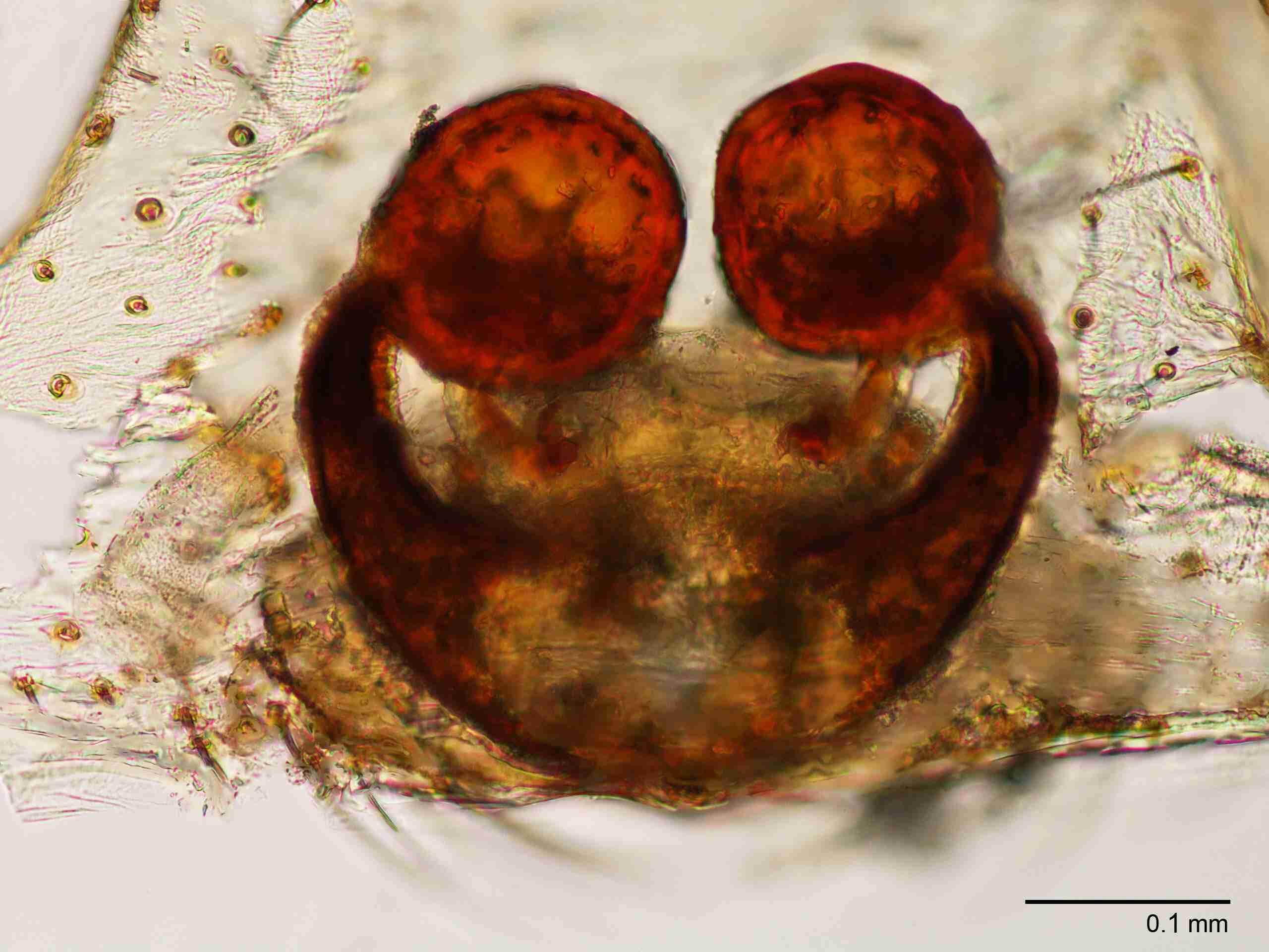 XILTHER153fpepidJAM518_200X_CAS.jpg