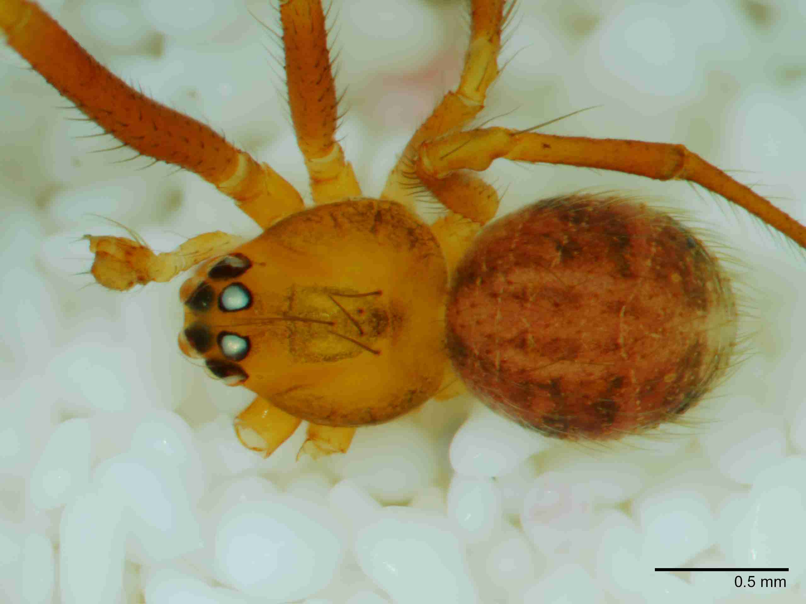 XILTHER152mphabdJAM517_50X_Z10.jpg
