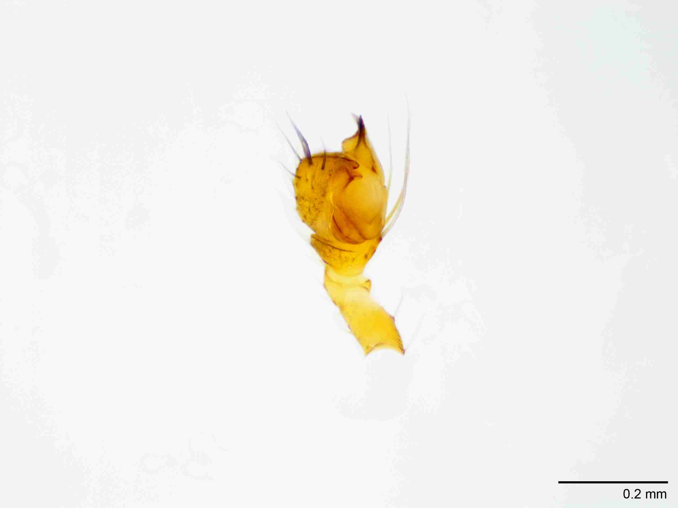 XILTHER152mppalpJAM517_100X_E2A.jpg