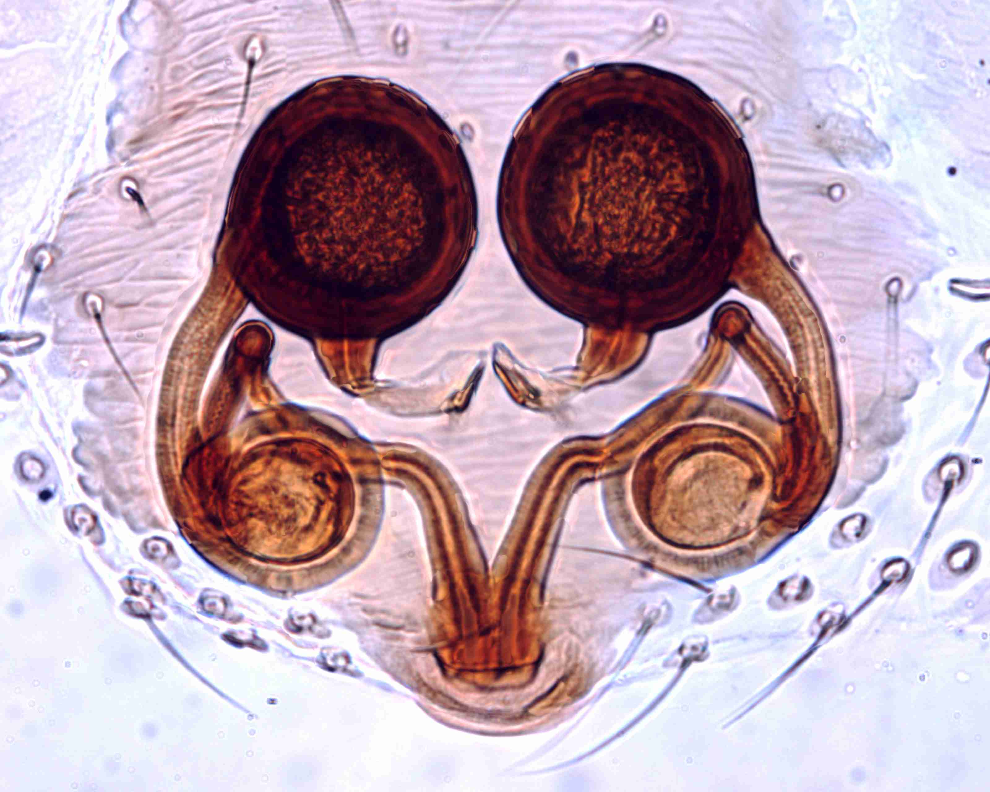 XILTHER154fpepidJAM332_400X_E2A.jpg