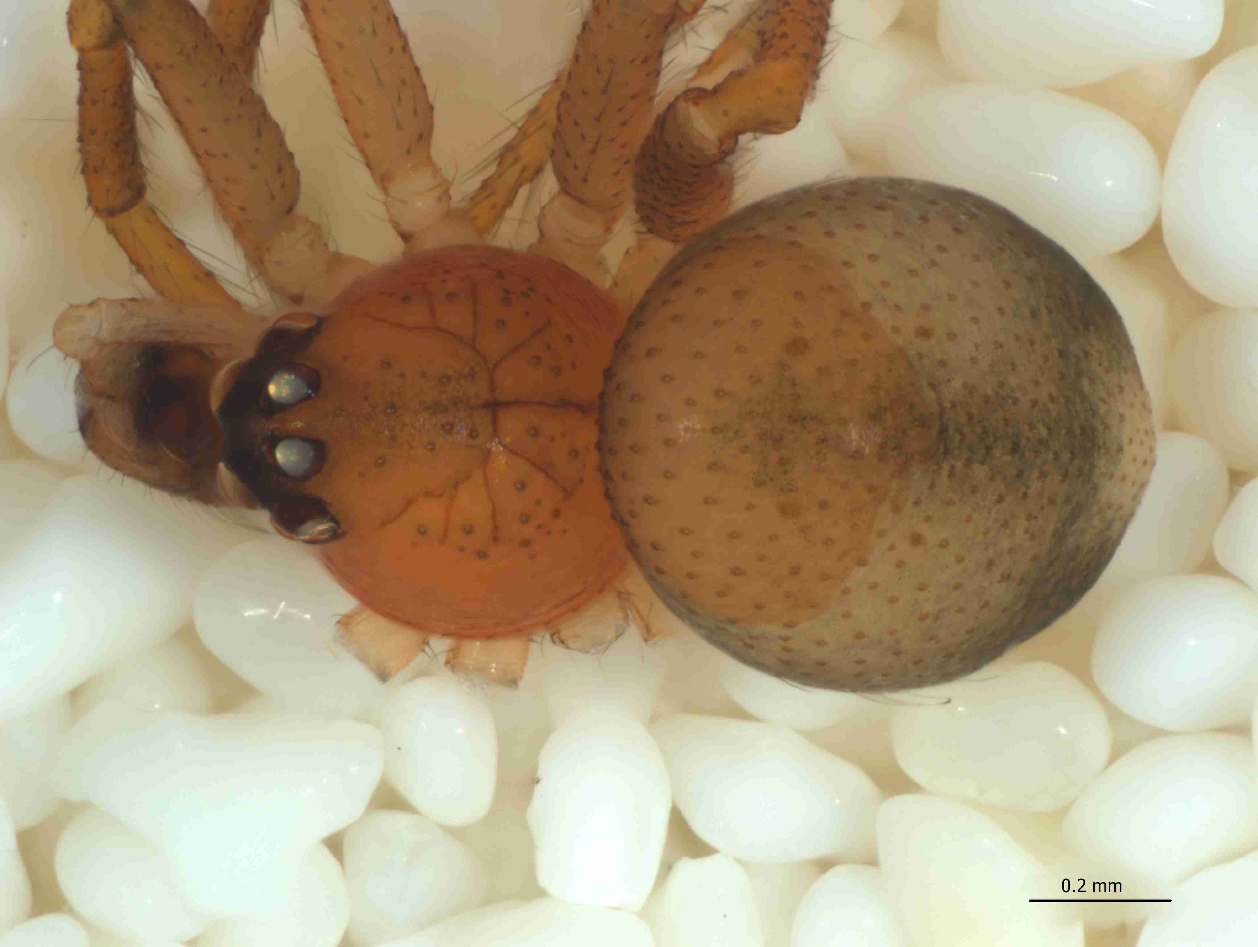 XILTHER154mphabdJAM332_78X_CAS.jpg