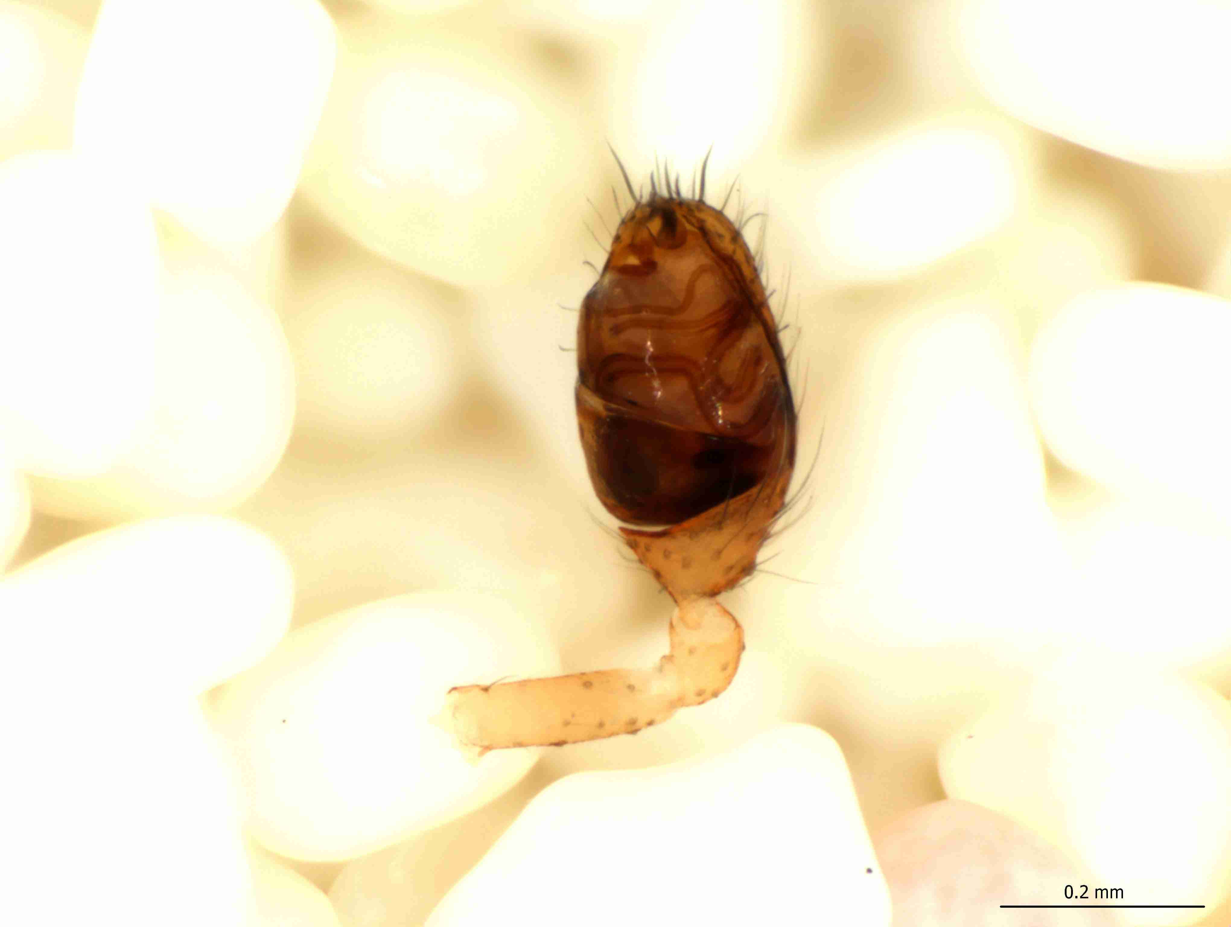 XILTHER154mppalvJAM332_115X_CAS.jpg