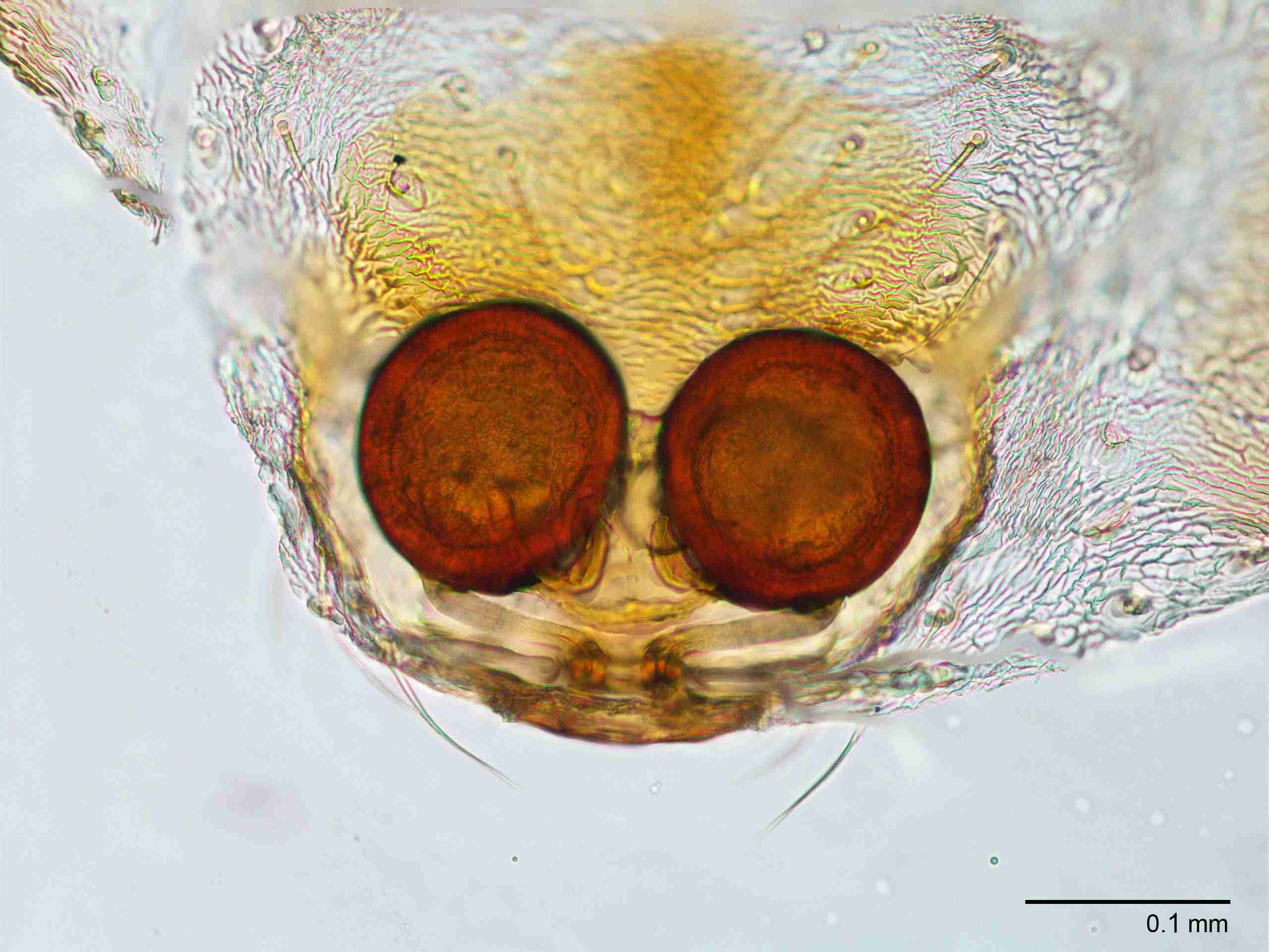 XILTHER155fpepidJAM221_200X_CAS.jpg